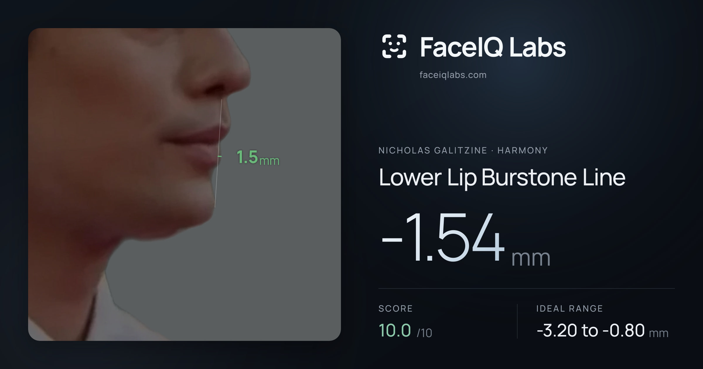 Nicholas Galitzine Lower Lip Burstone Line: -1.54mm, drawn on the photo
