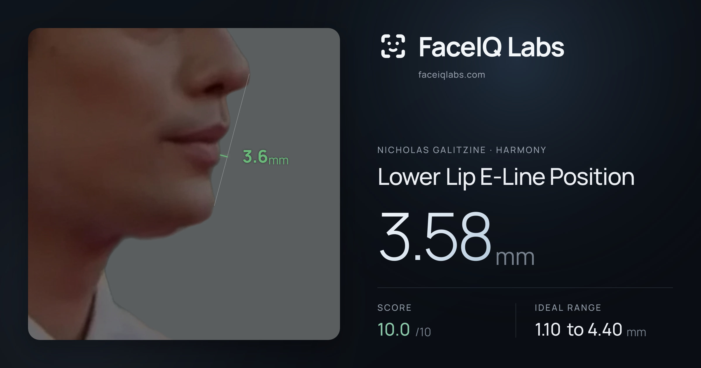 Nicholas Galitzine Lower Lip E-Line Position: 3.58mm, drawn on the photo