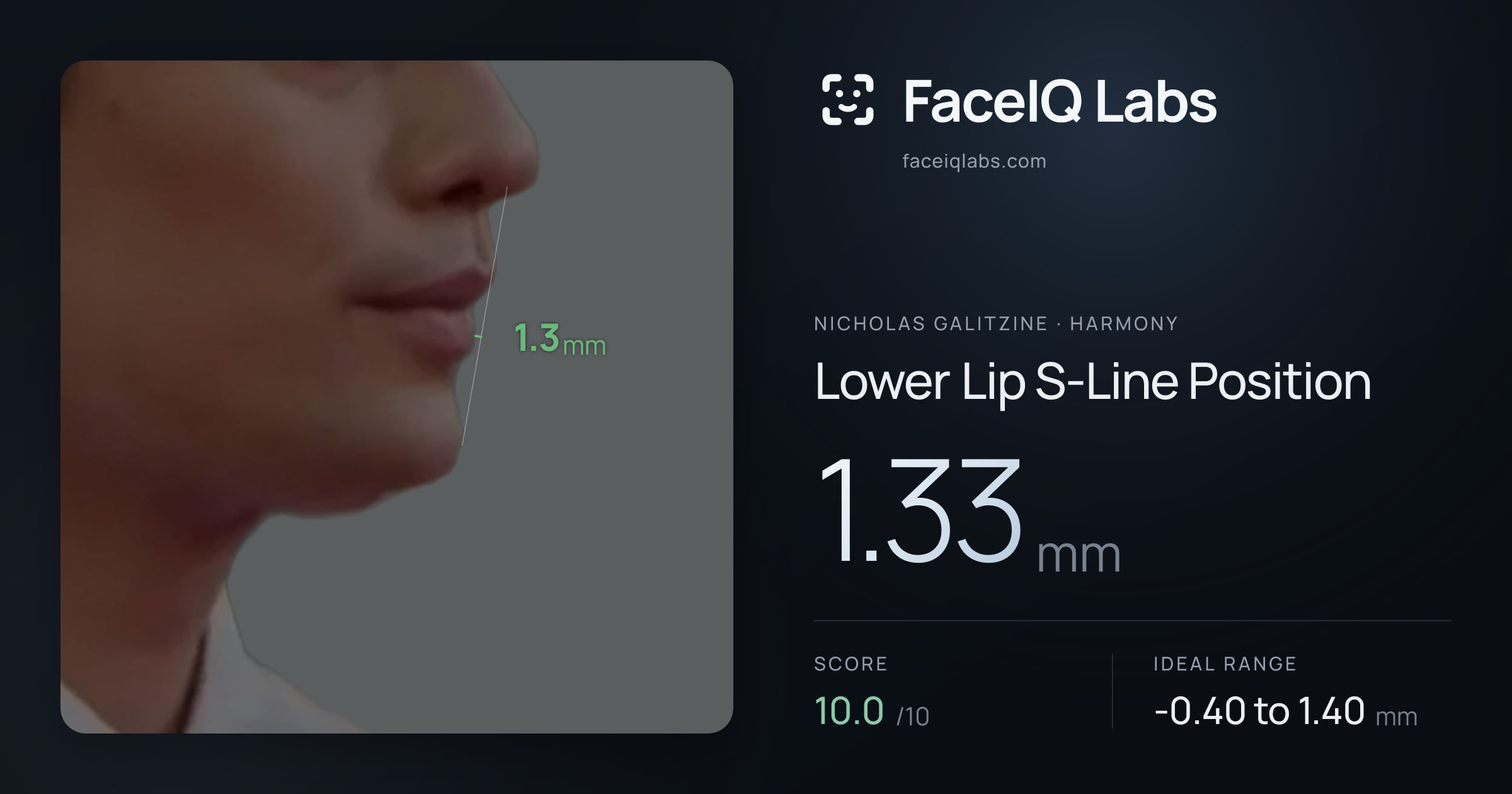 Nicholas Galitzine Lower Lip S-Line Position: 1.33mm, drawn on the photo