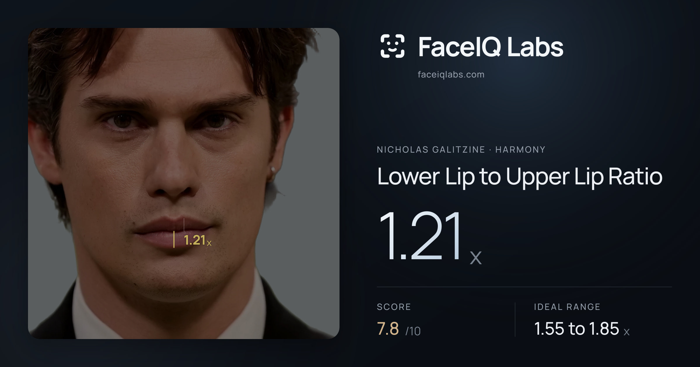 Nicholas Galitzine Lower Lip to Upper Lip Ratio: 1.21x, drawn on the photo