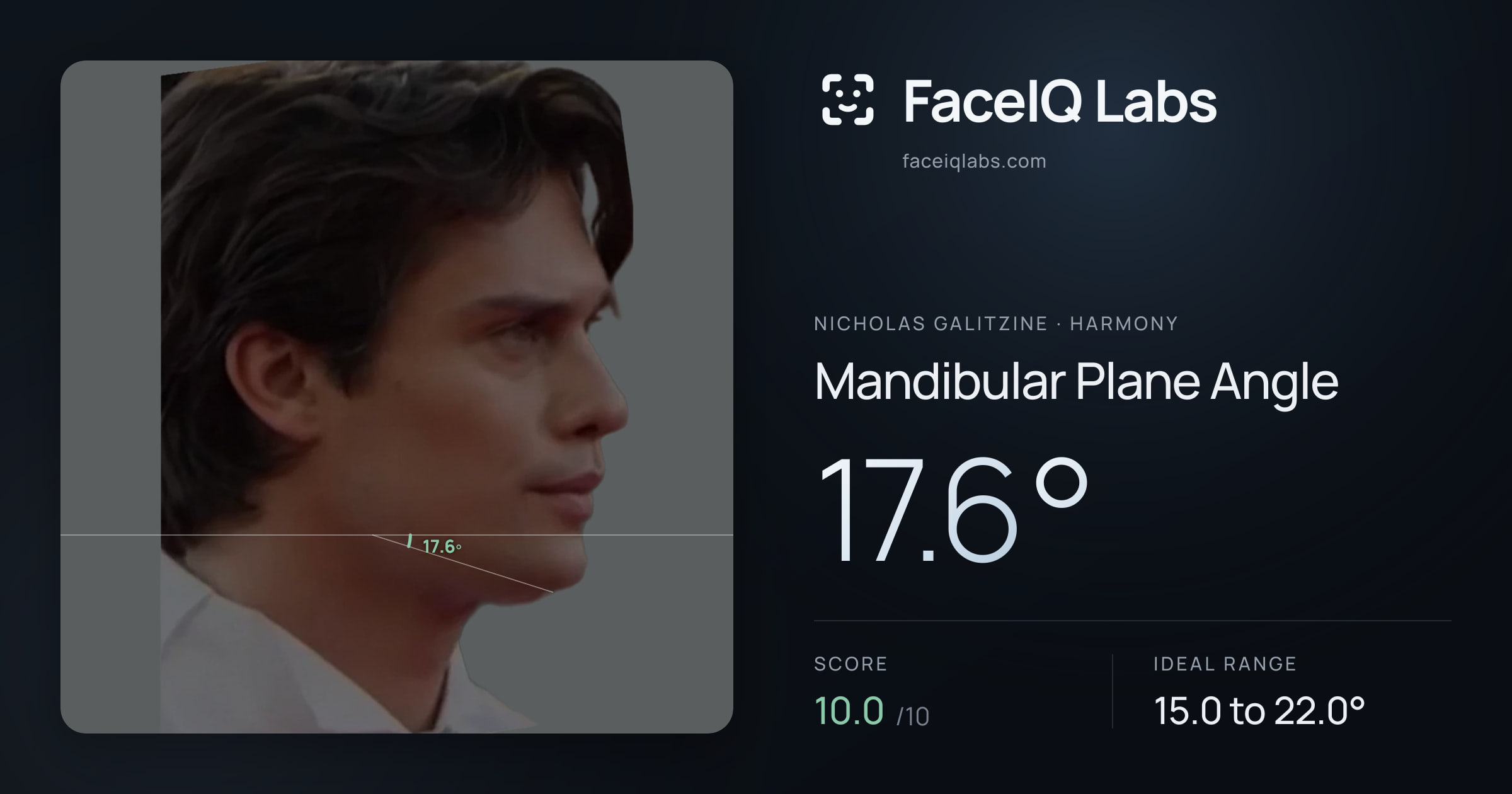 Nicholas Galitzine Mandibular Plane Angle: 17.6°, drawn on the photo
