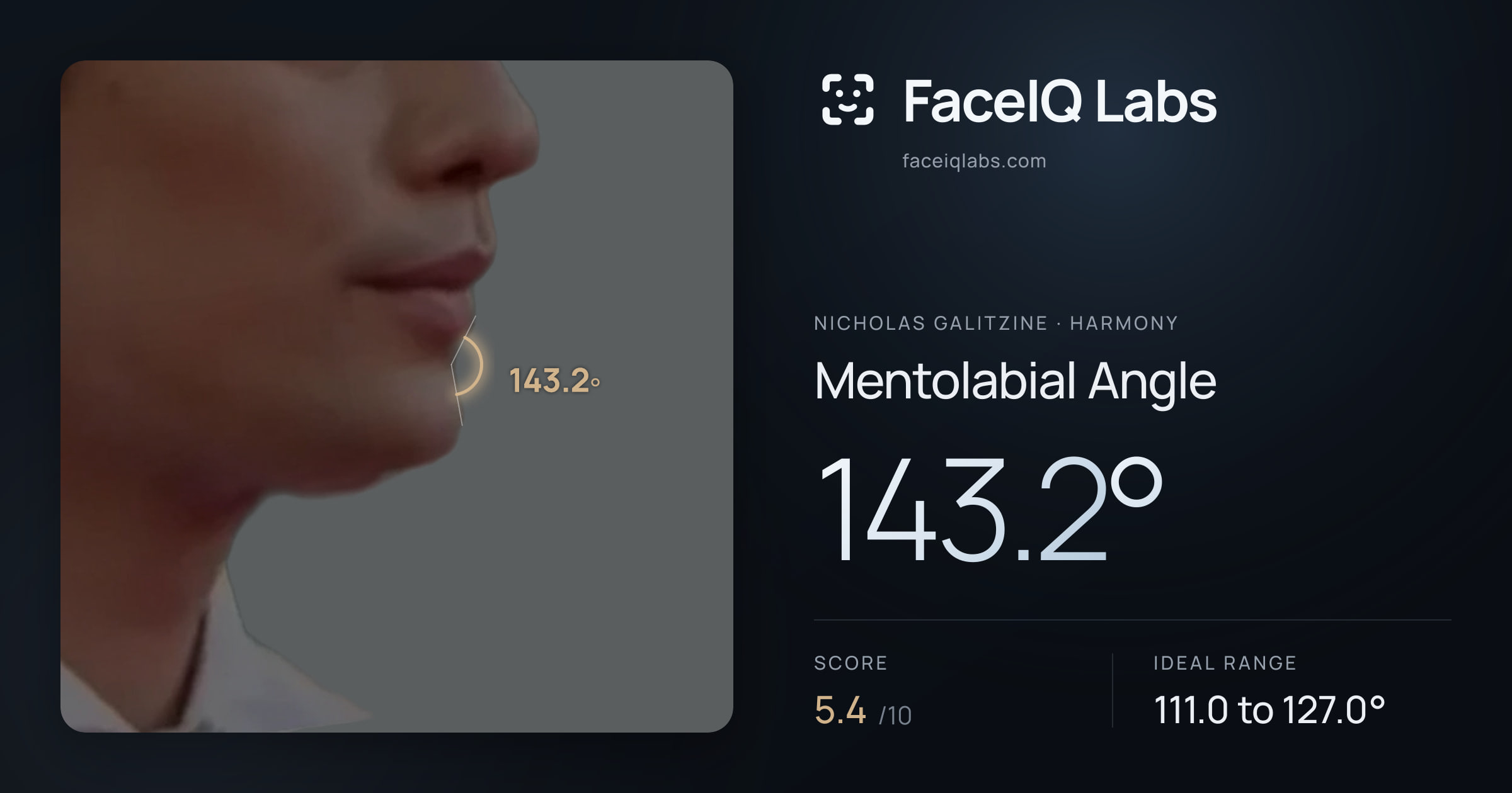 Nicholas Galitzine Mentolabial Angle: 143.2°, drawn on the photo