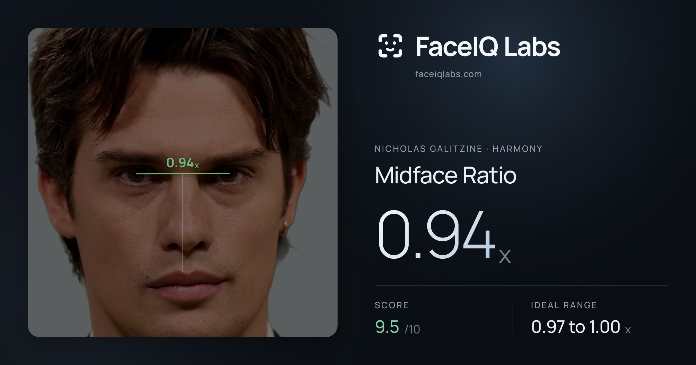 Nicholas Galitzine Midface Ratio: 0.94x, drawn on the photo