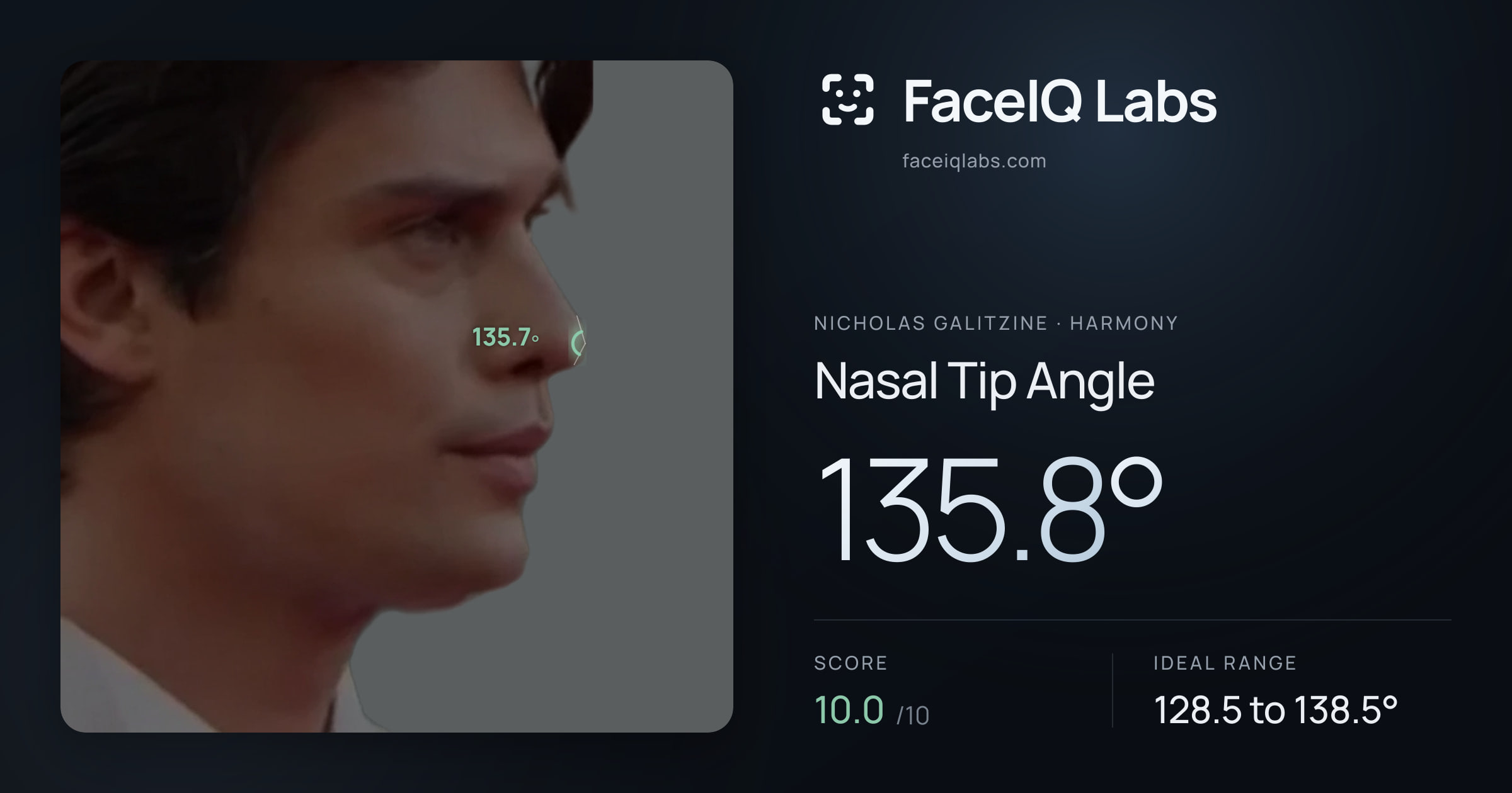 Nicholas Galitzine Nasal Tip Angle: 135.8°, drawn on the photo