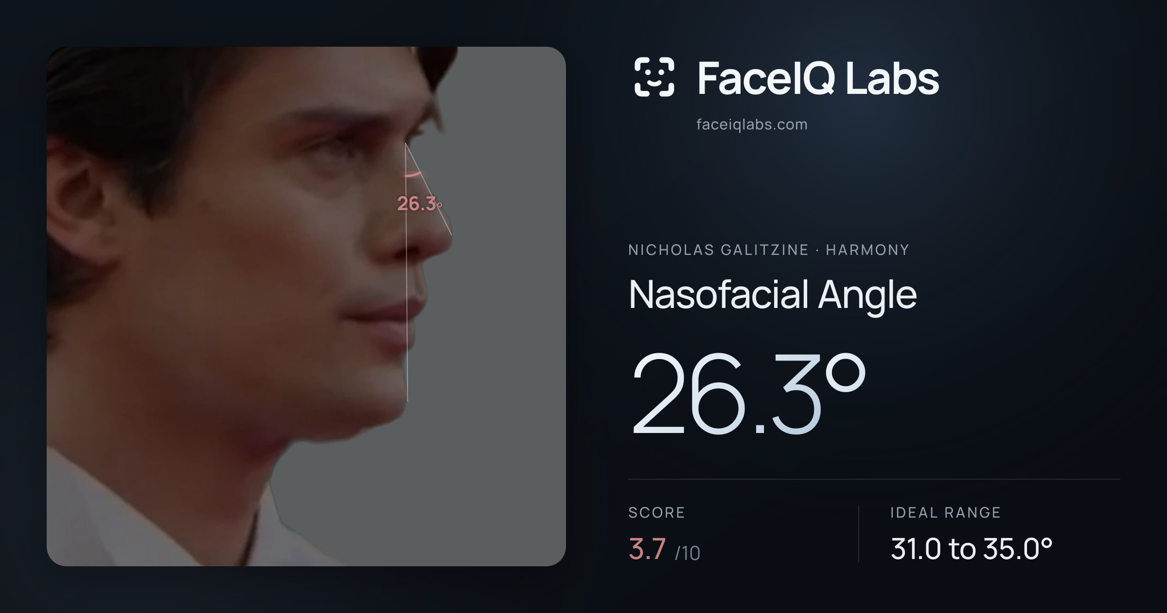Nicholas Galitzine Nasofacial Angle: 26.3°, drawn on the photo