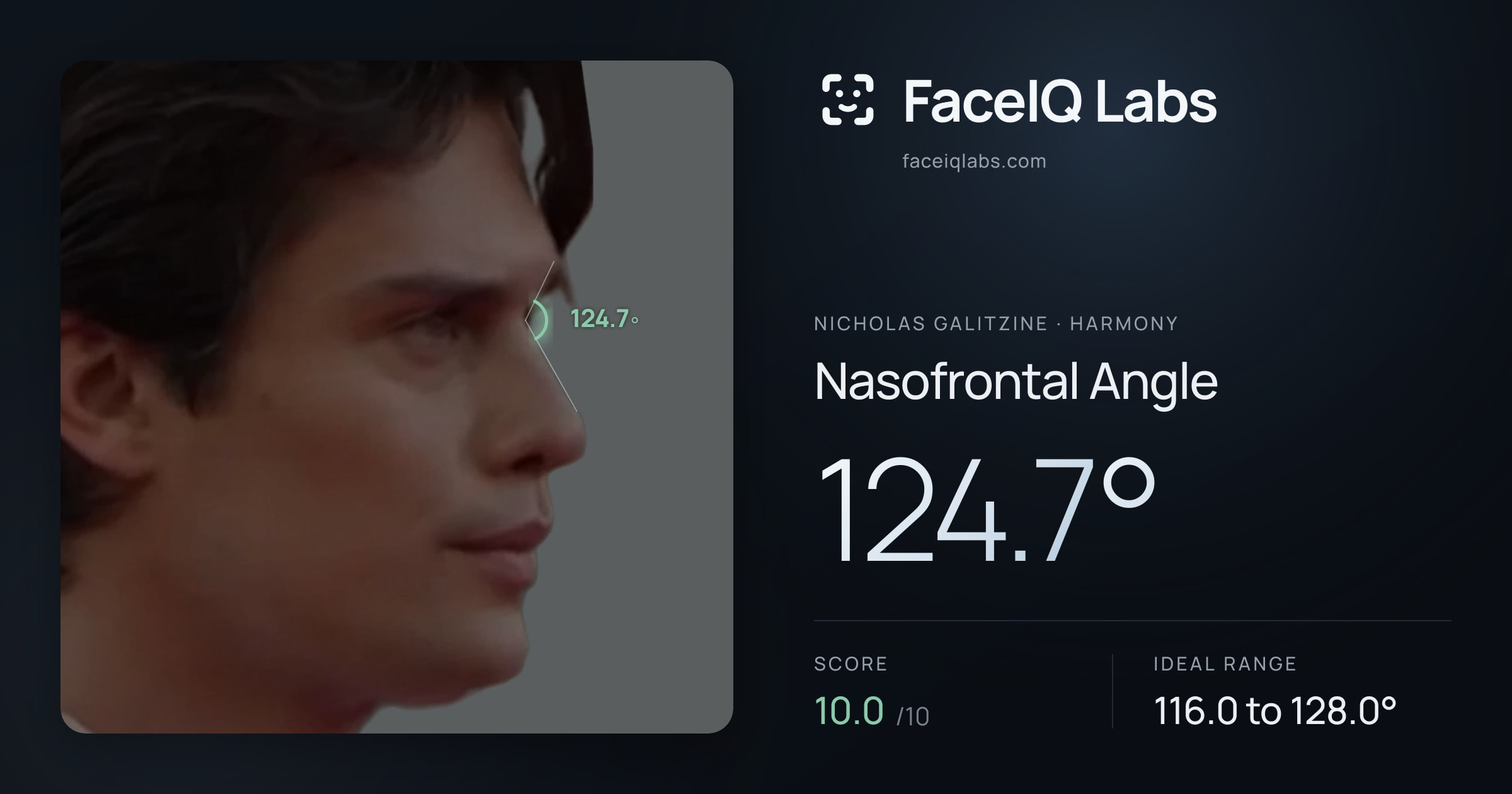 Nicholas Galitzine Nasofrontal Angle: 124.7°, drawn on the photo