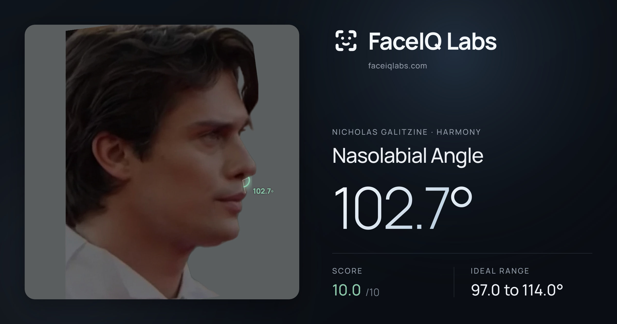 Nicholas Galitzine Nasolabial Angle: 102.7°, drawn on the photo