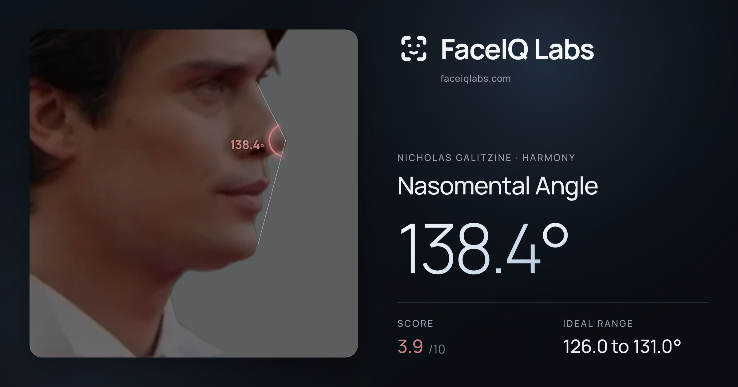 Nicholas Galitzine Nasomental Angle: 138.4°, drawn on the photo