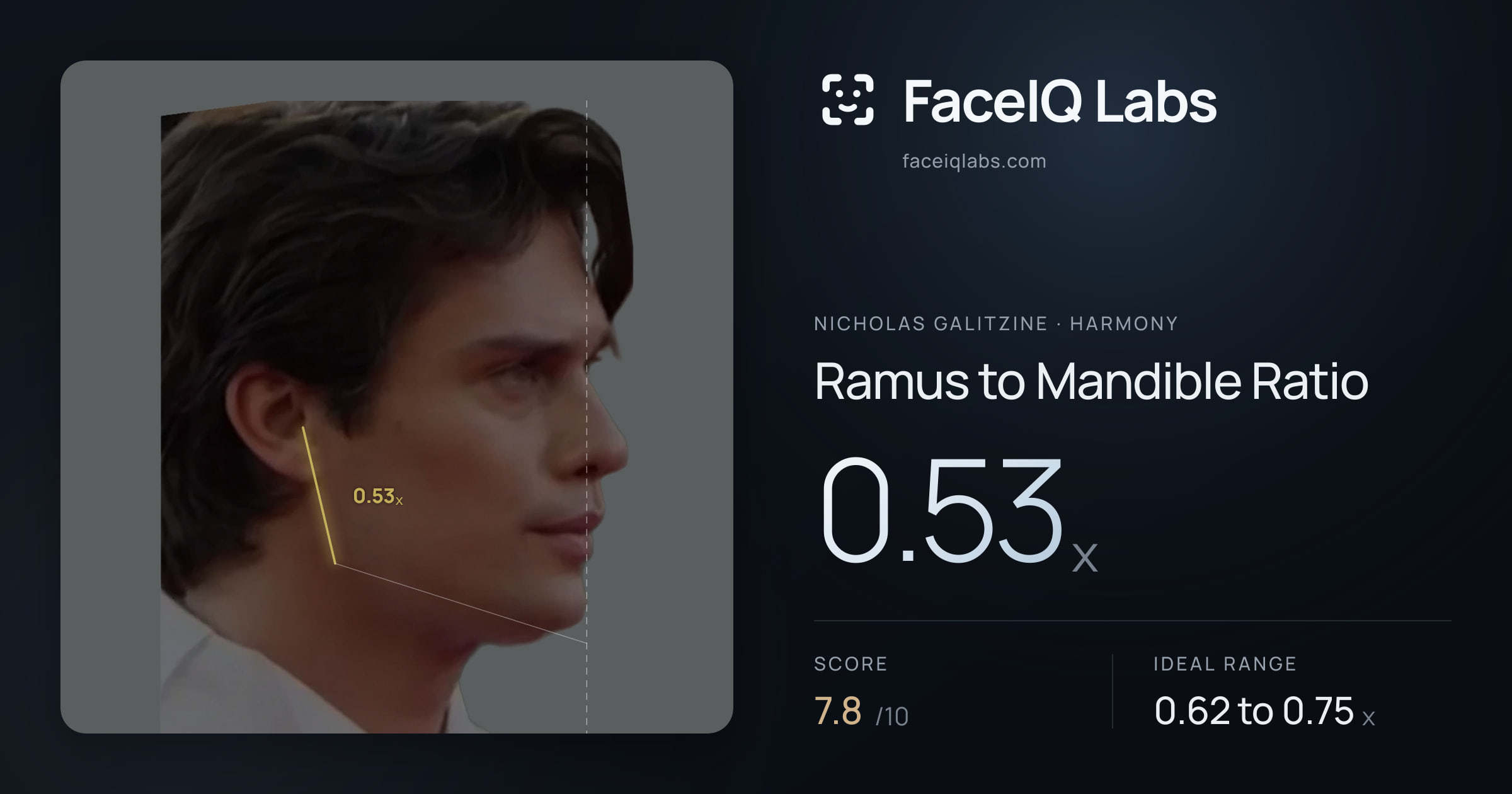 Nicholas Galitzine Ramus to Mandible Ratio: 0.53x, drawn on the photo