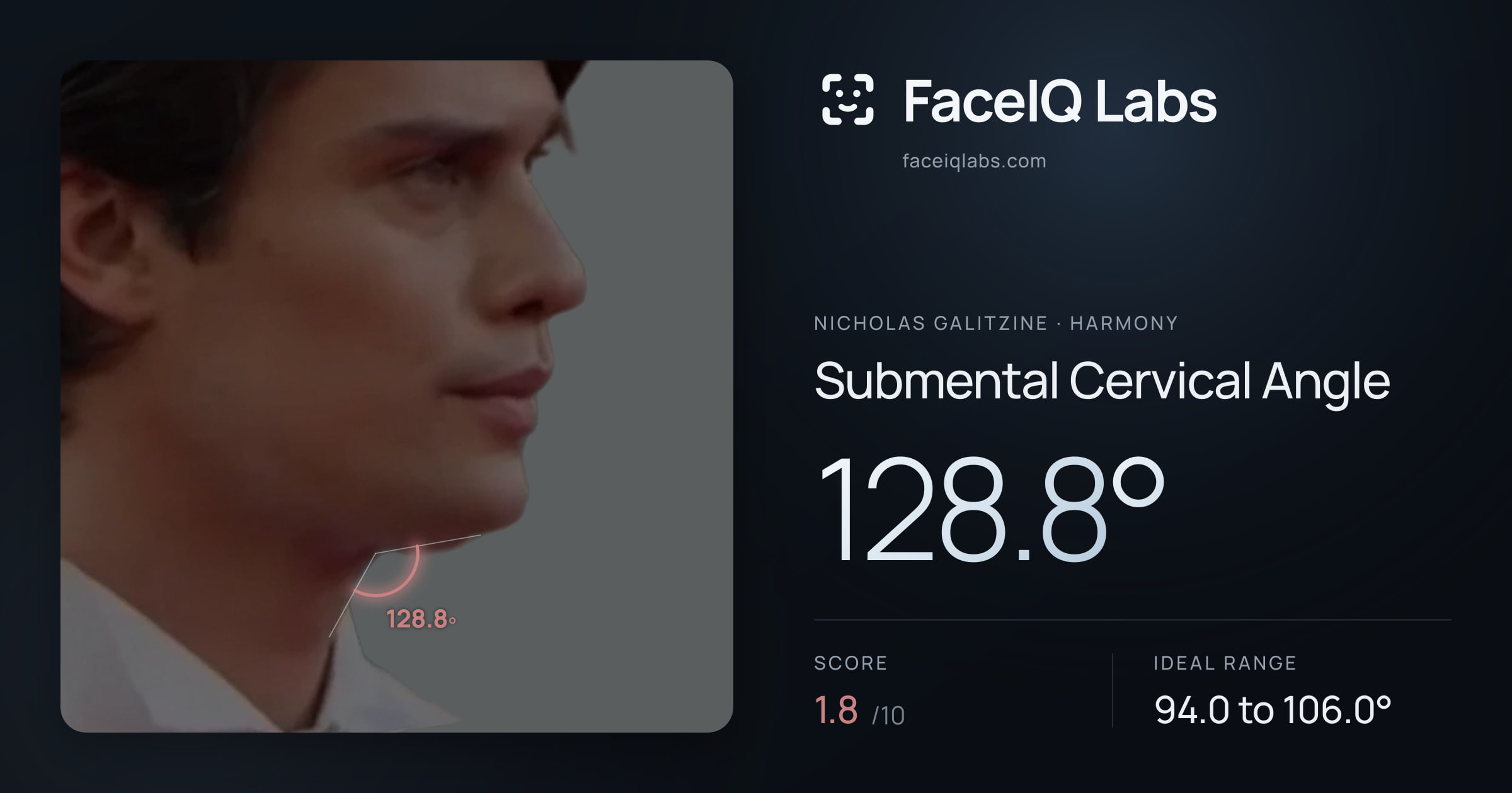 Nicholas Galitzine Submental Cervical Angle: 128.8°, drawn on the photo