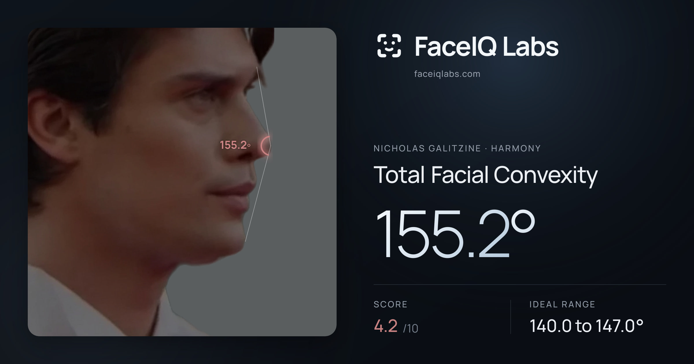 Nicholas Galitzine Total Facial Convexity: 155.2°, drawn on the photo