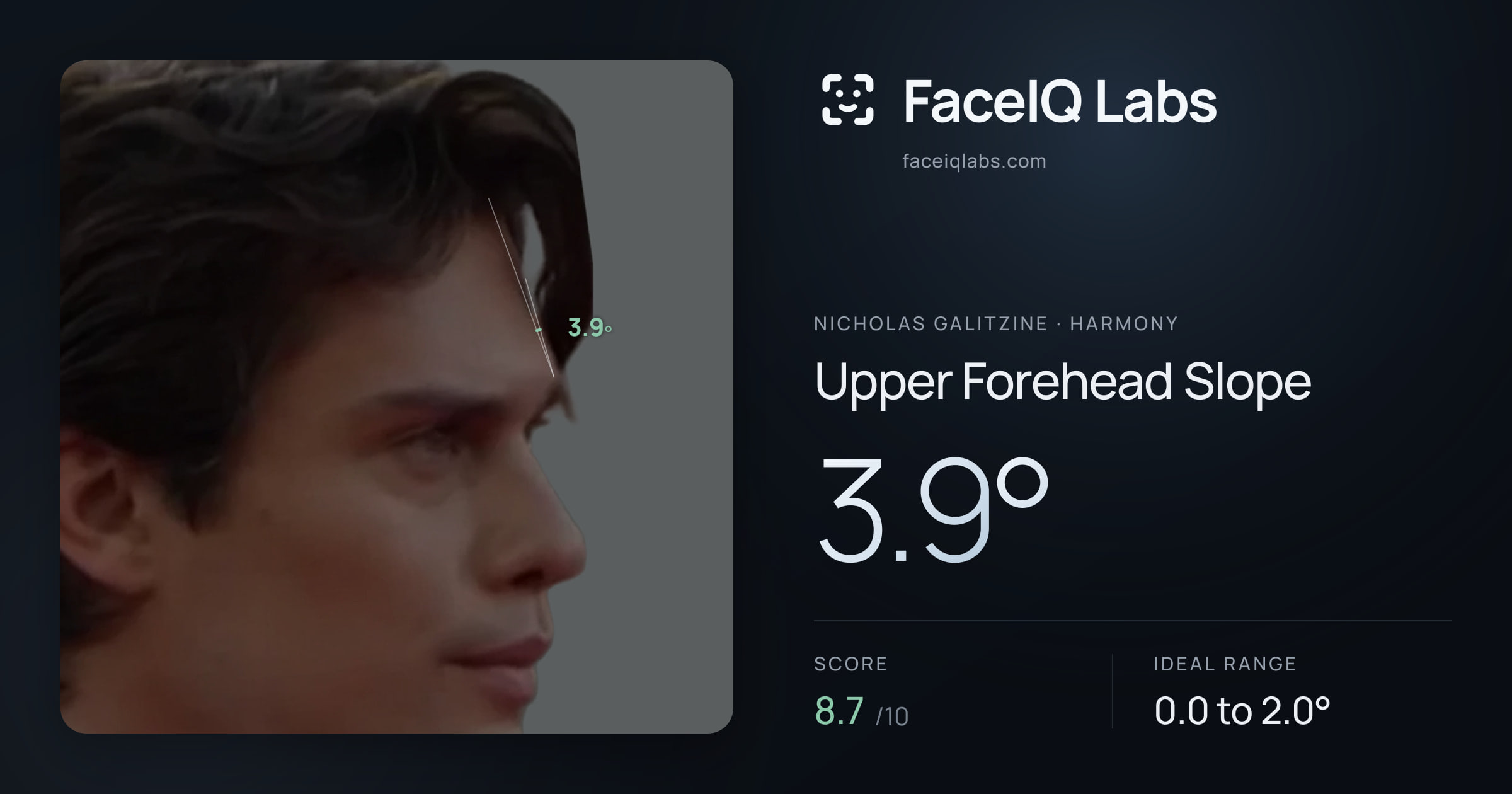 Nicholas Galitzine Upper Forehead Slope: 3.9°, drawn on the photo