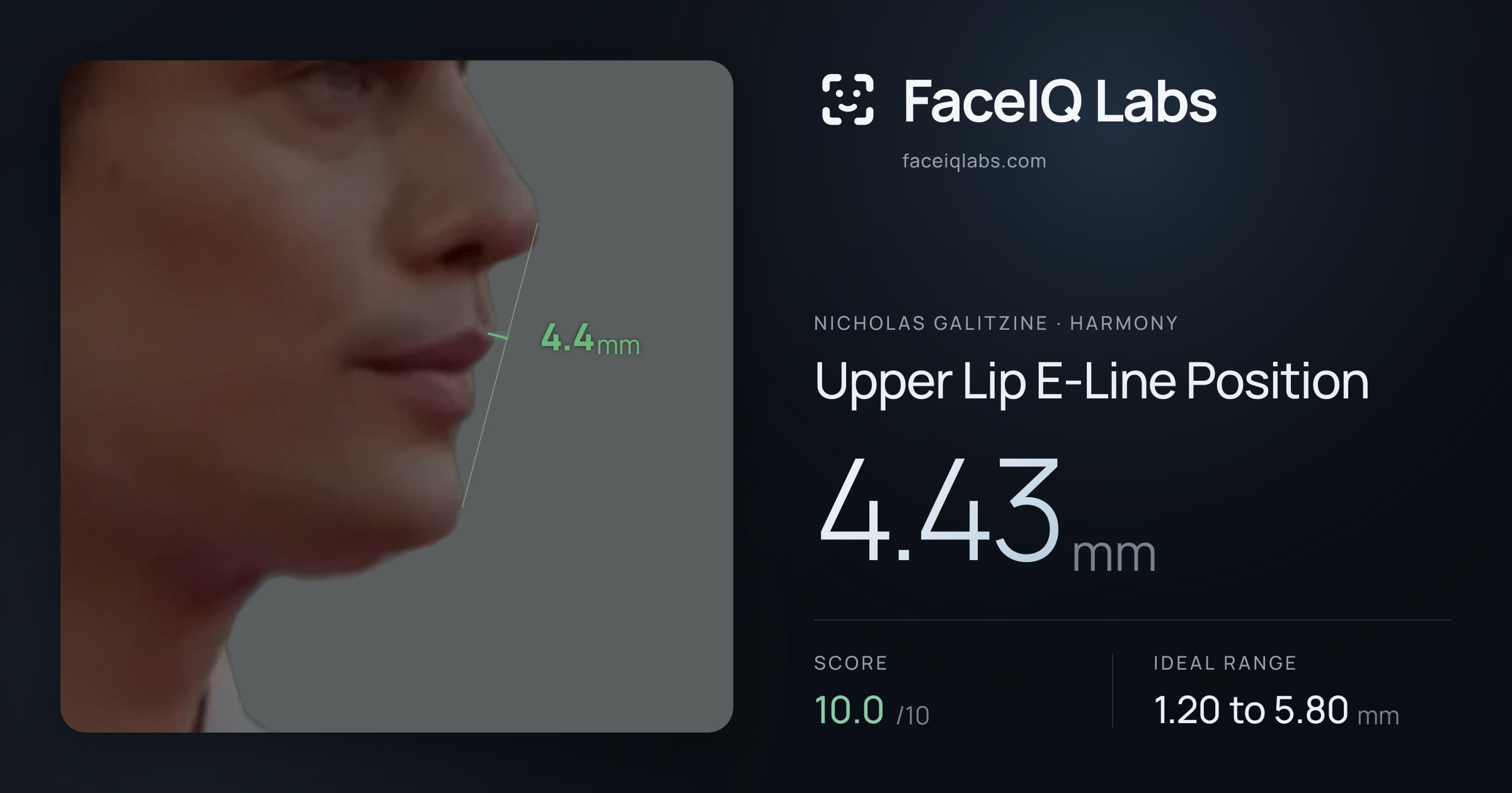 Nicholas Galitzine Upper Lip E-Line Position: 4.43mm, drawn on the photo