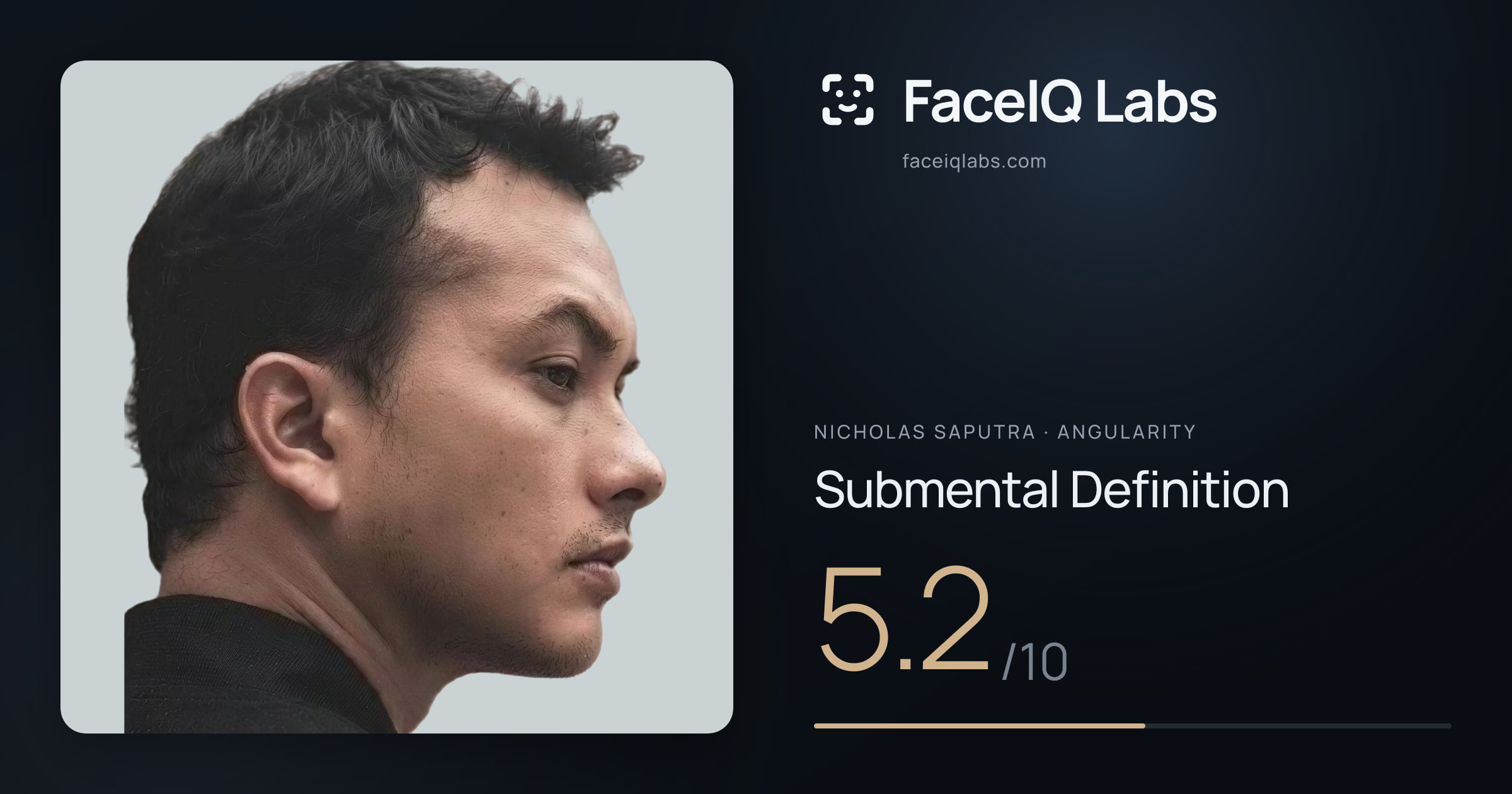 Nicholas Saputra Submental Definition: 5.2/10, drawn on the photo