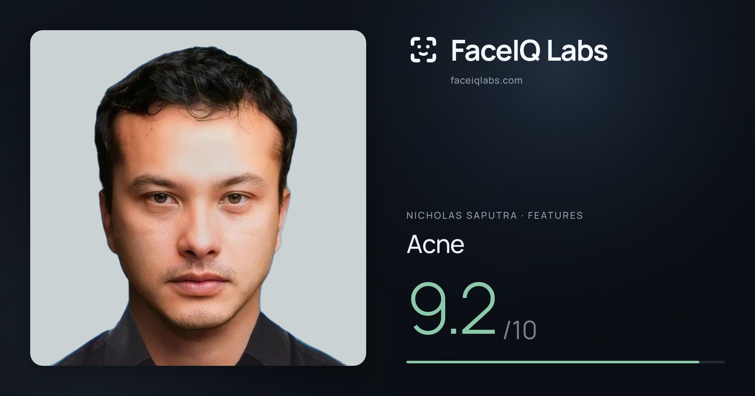 Nicholas Saputra Acne: 9.2/10, drawn on the photo
