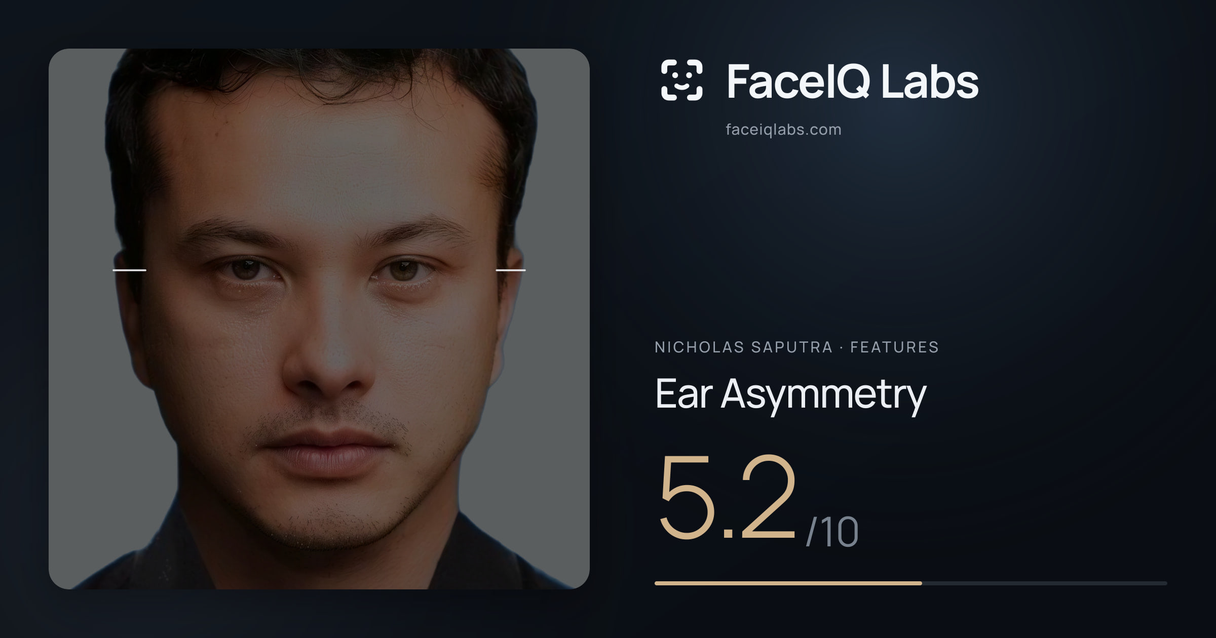 Nicholas Saputra Ear Asymmetry: 5.2/10, drawn on the photo