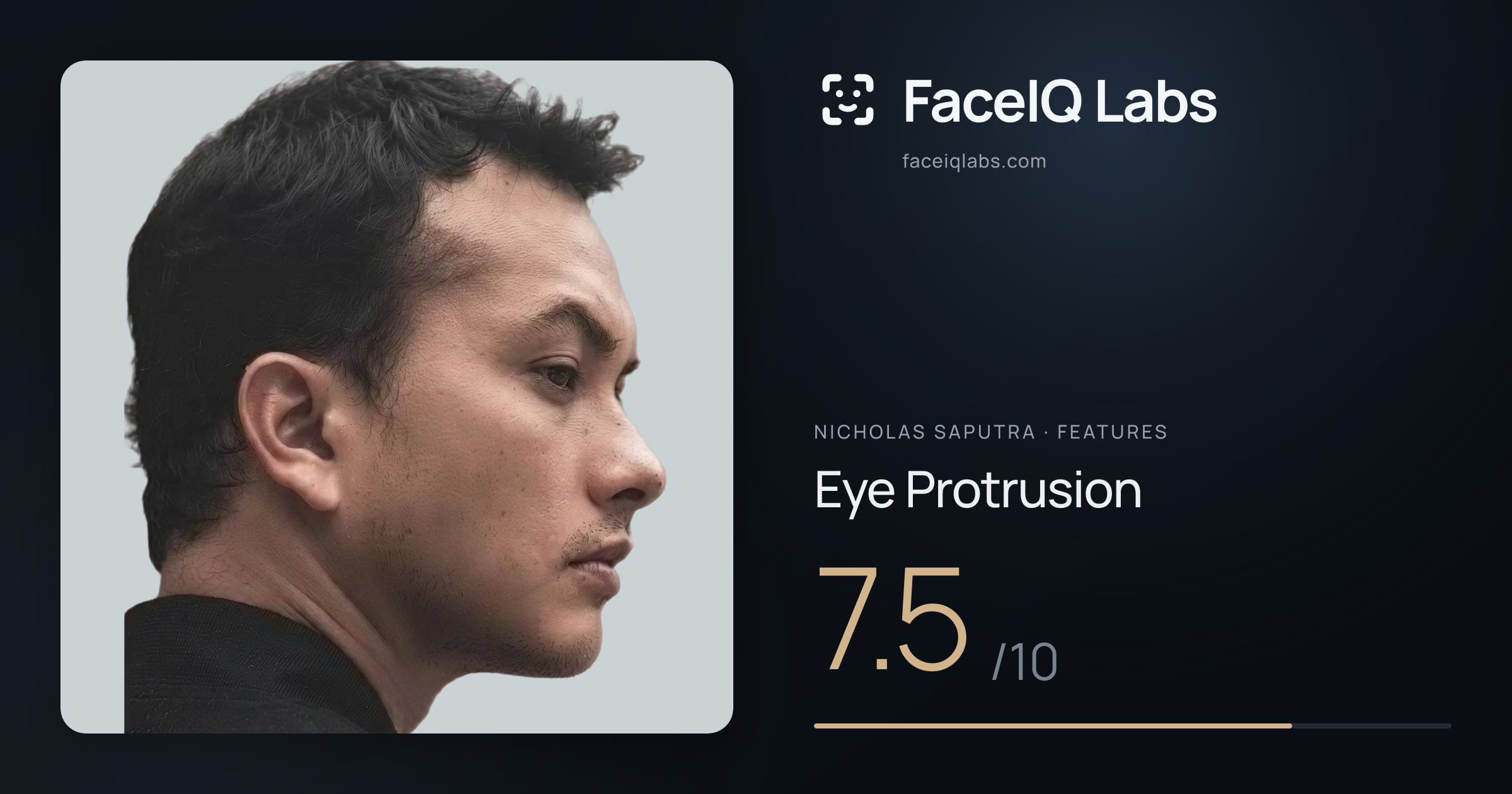 Nicholas Saputra Eye Protrusion: 7.5/10, drawn on the photo