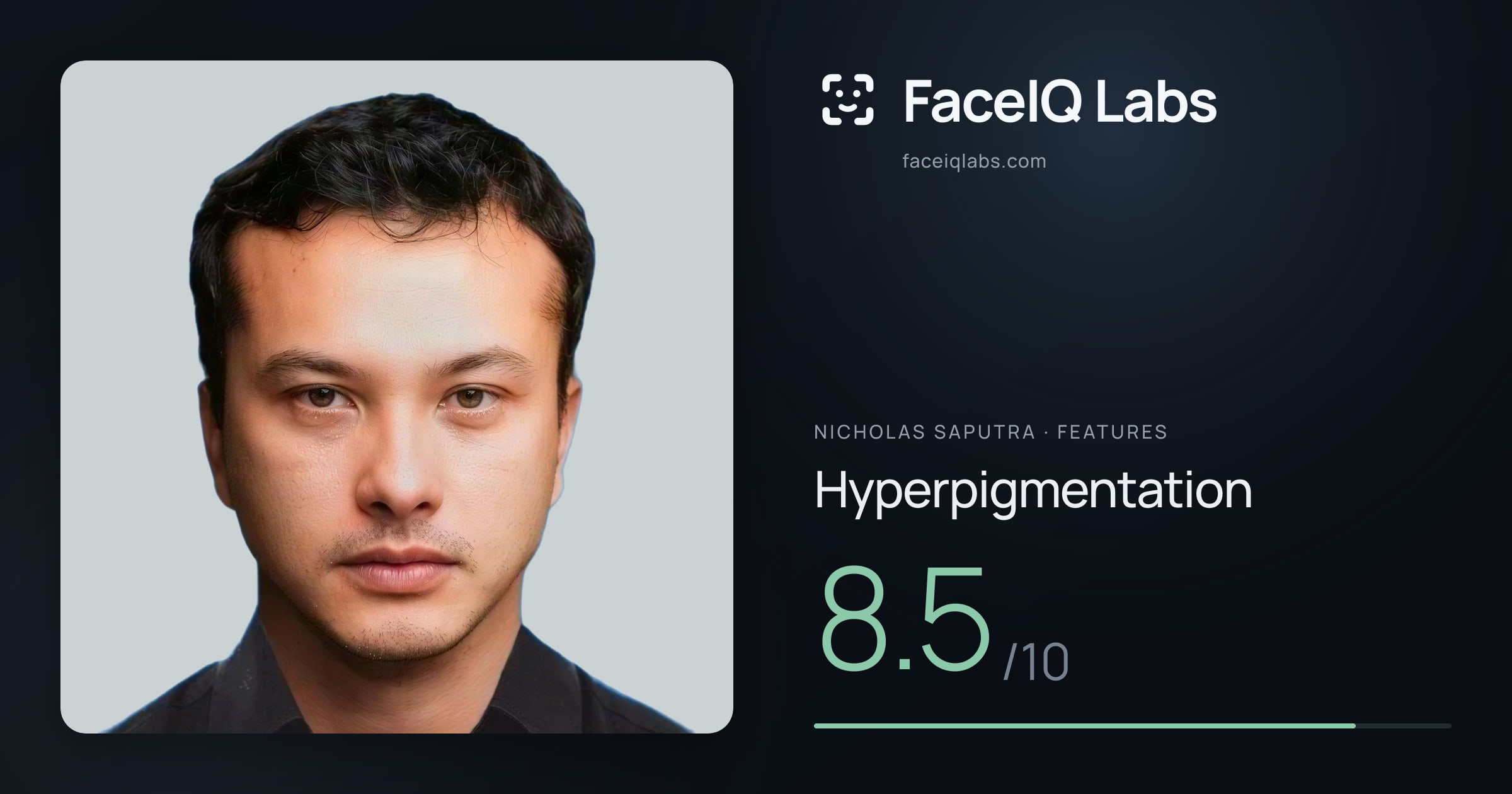 Nicholas Saputra Hyperpigmentation: 8.5/10, drawn on the photo