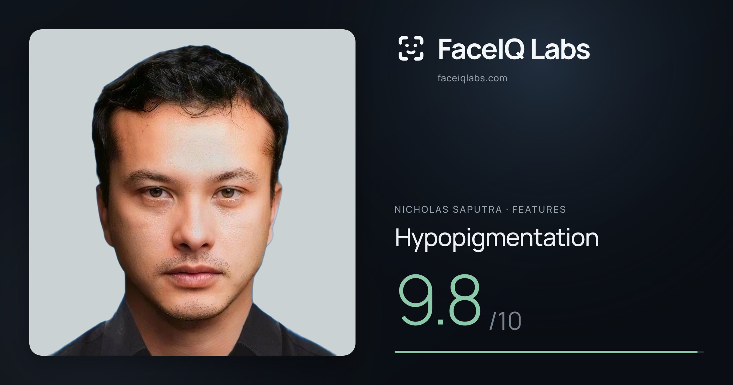 Nicholas Saputra Hypopigmentation: 9.8/10, drawn on the photo