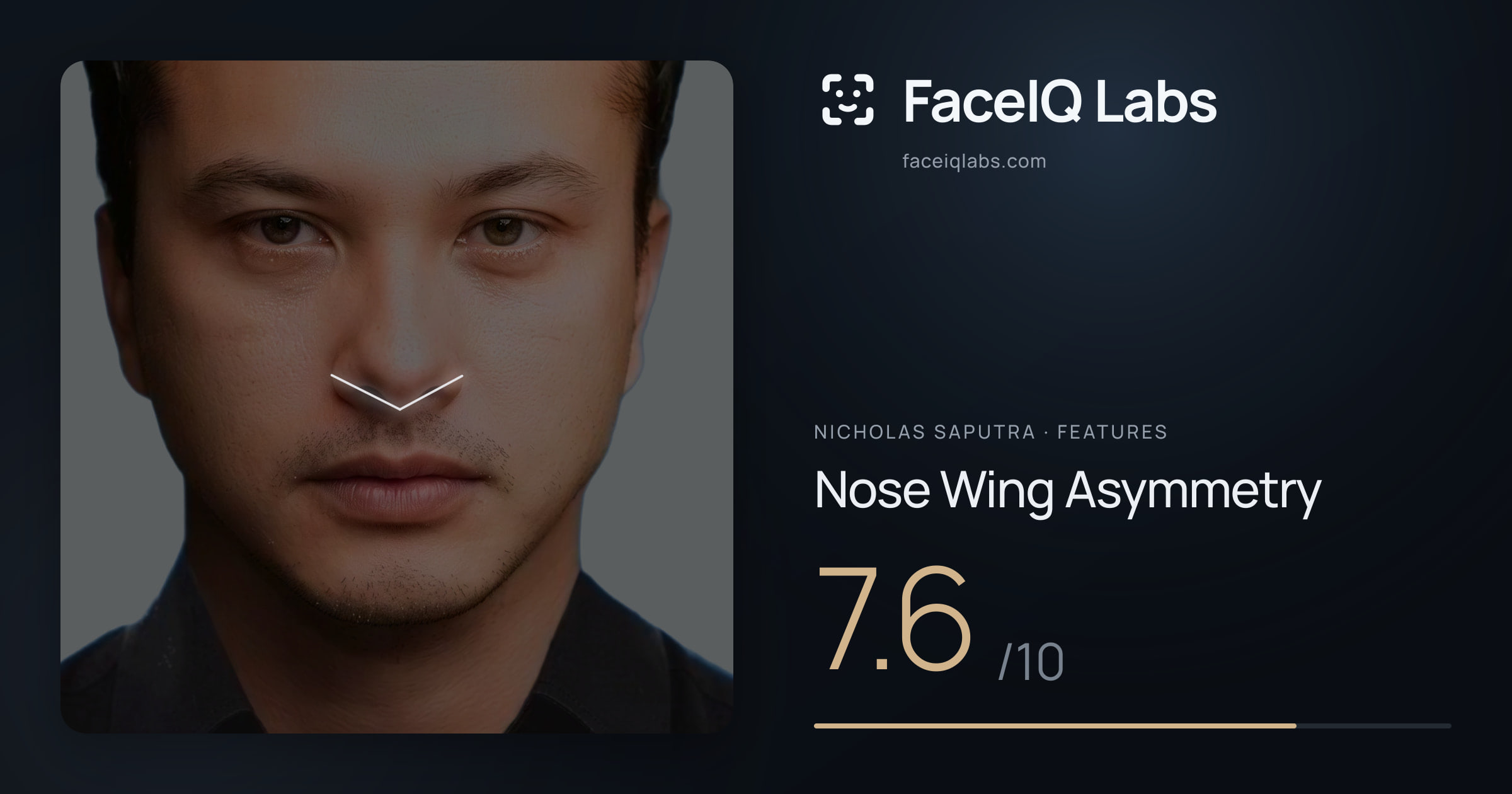 Nicholas Saputra Nose Wing Asymmetry: 7.6/10, drawn on the photo