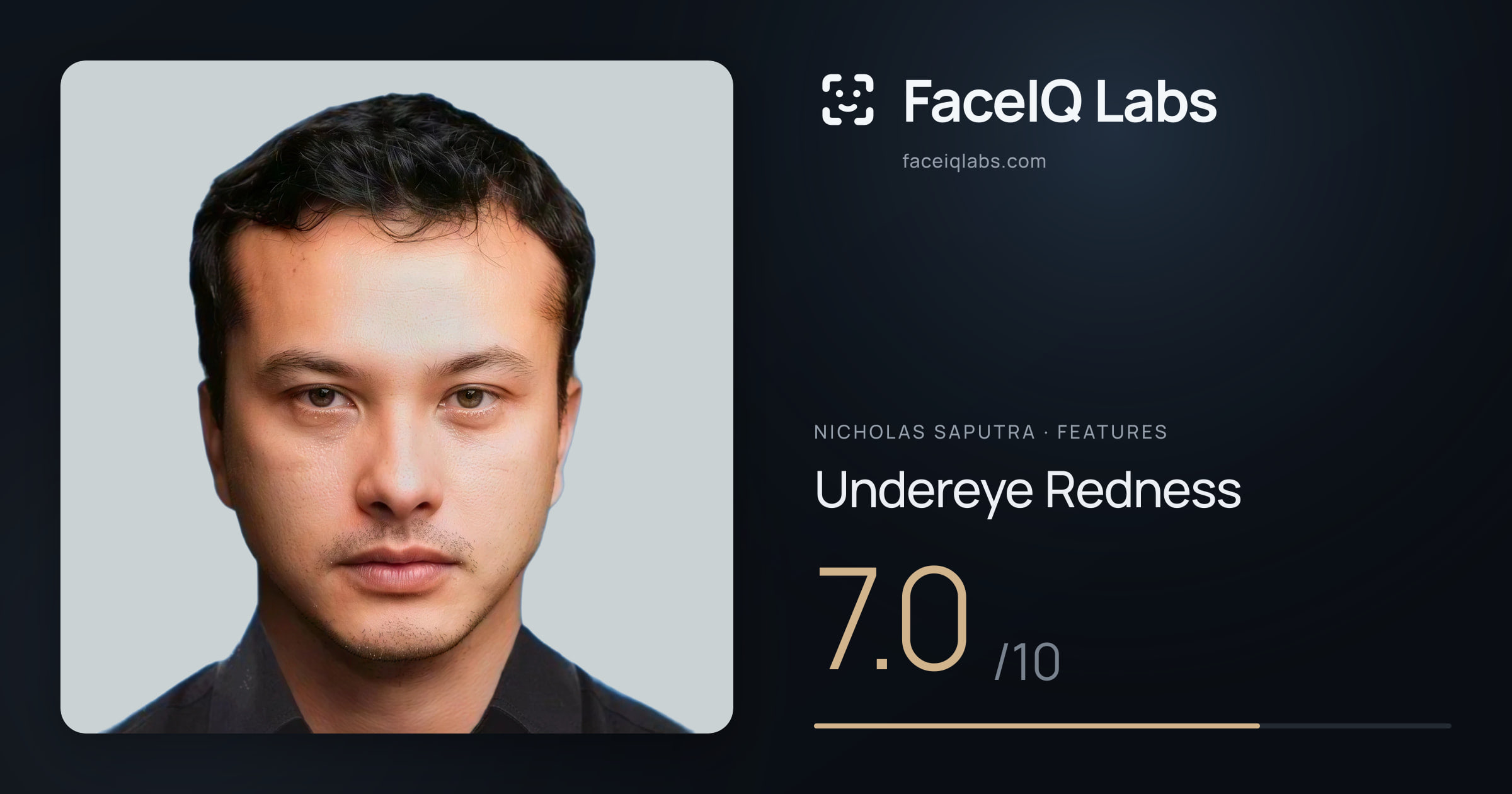 Nicholas Saputra Undereye Redness: 7.0/10, drawn on the photo
