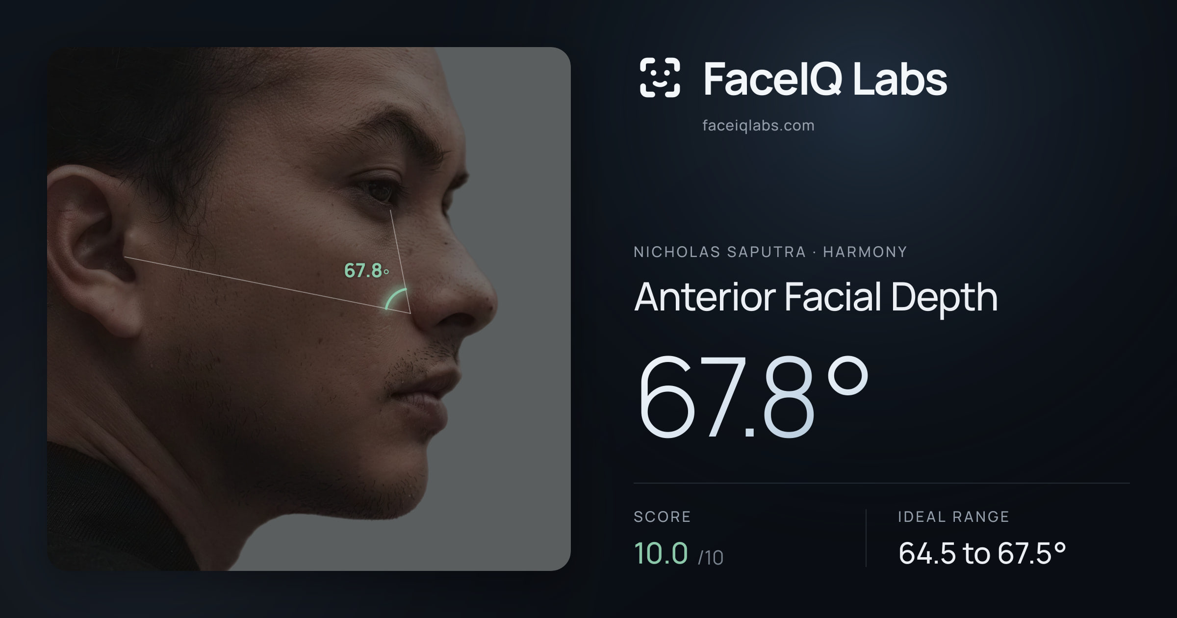 Nicholas Saputra Anterior Facial Depth: 67.8°, drawn on the photo
