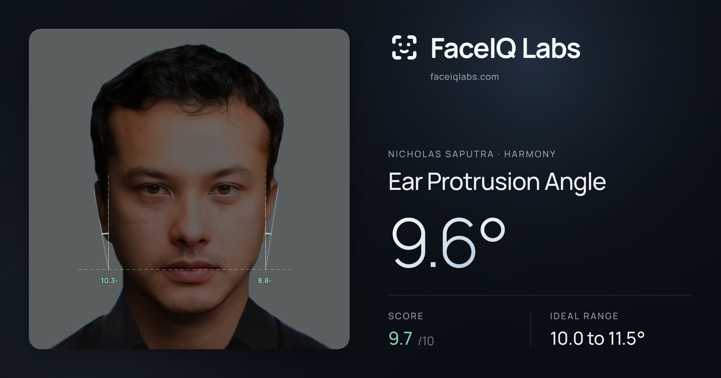 Nicholas Saputra Ear Protrusion Angle: 9.6°, drawn on the photo