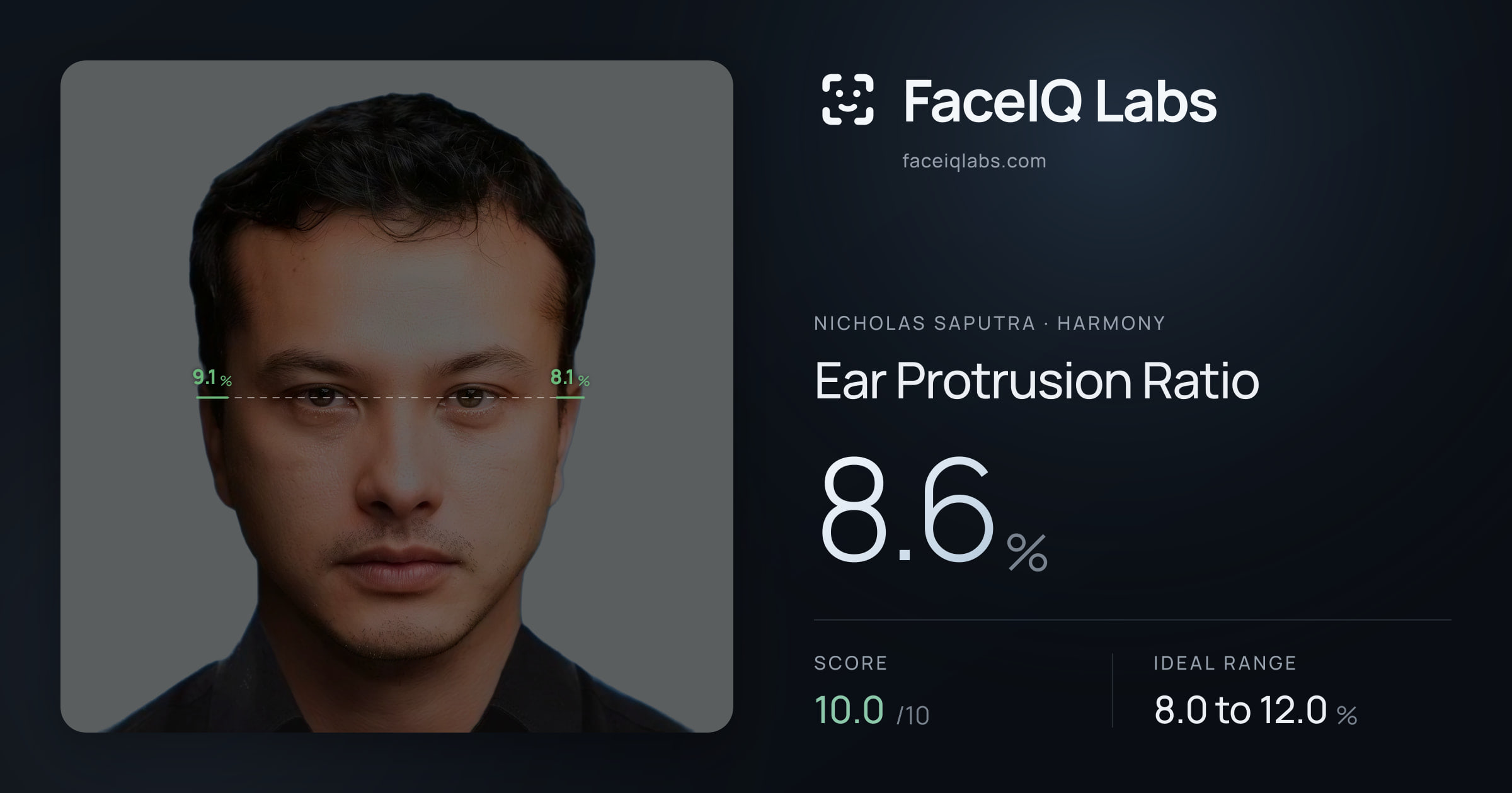 Nicholas Saputra Ear Protrusion Ratio: 8.6%, drawn on the photo