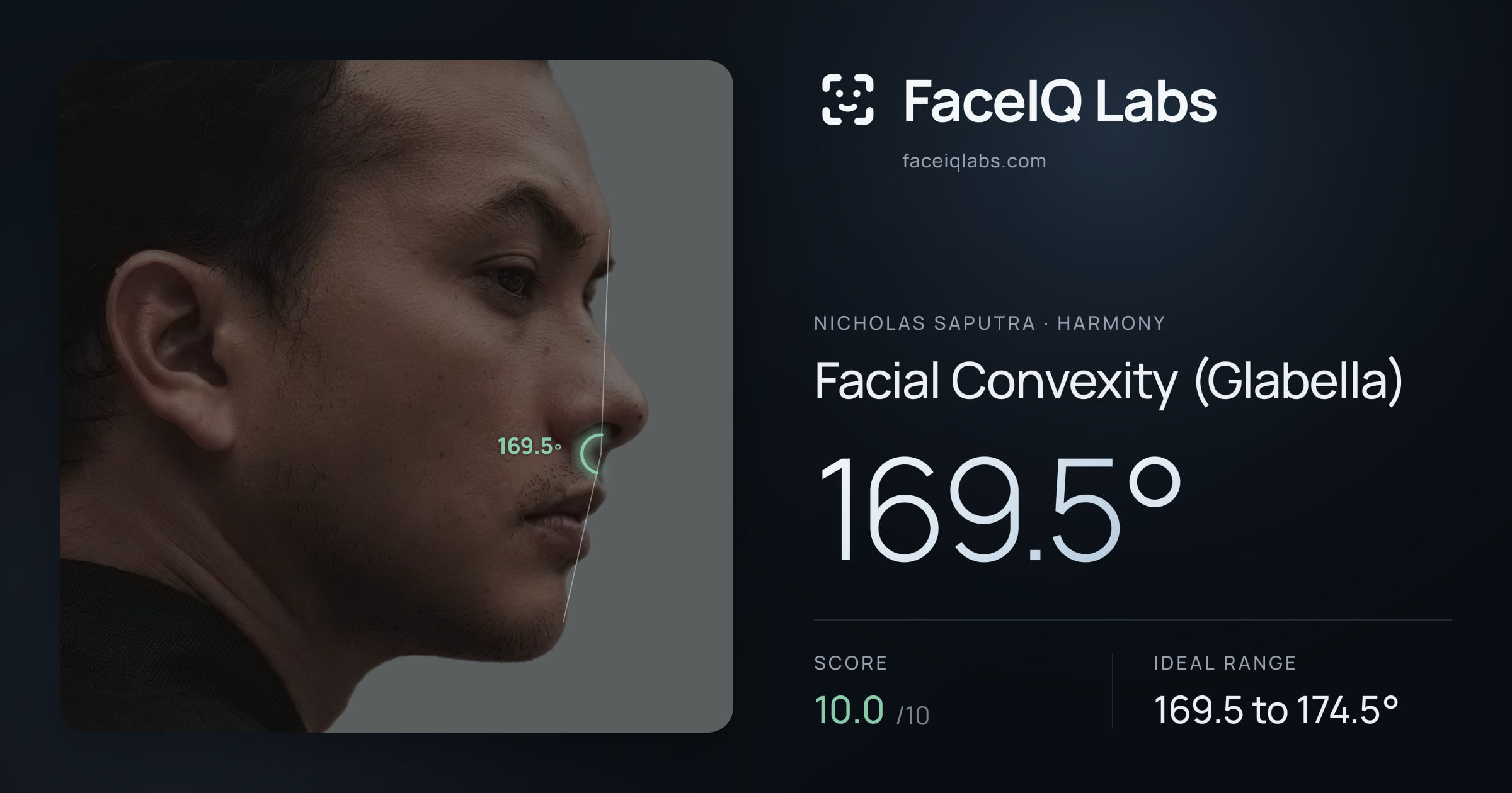 Nicholas Saputra Facial Convexity (Glabella): 169.5°, drawn on the photo