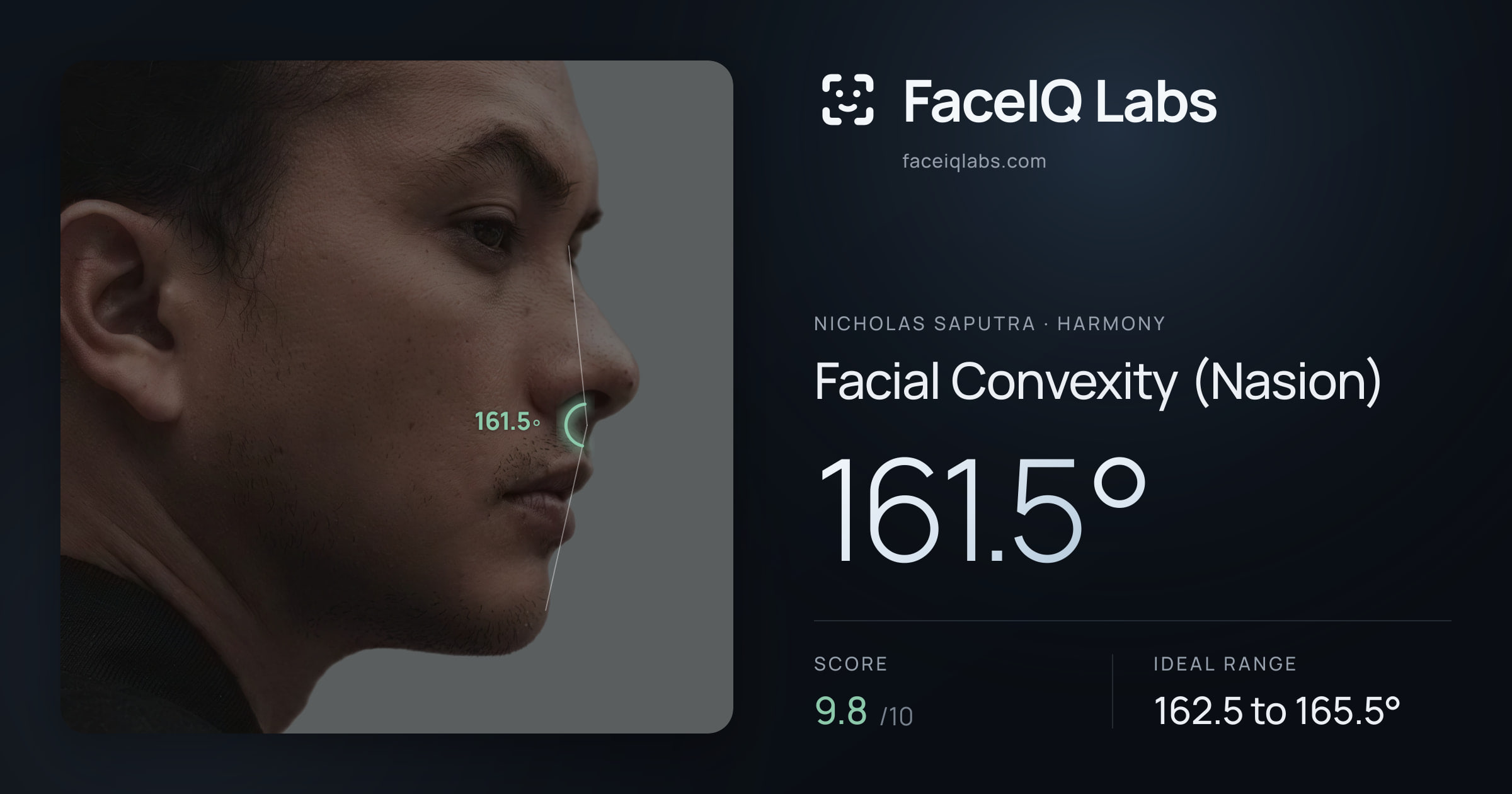 Nicholas Saputra Facial Convexity (Nasion): 161.5°, drawn on the photo