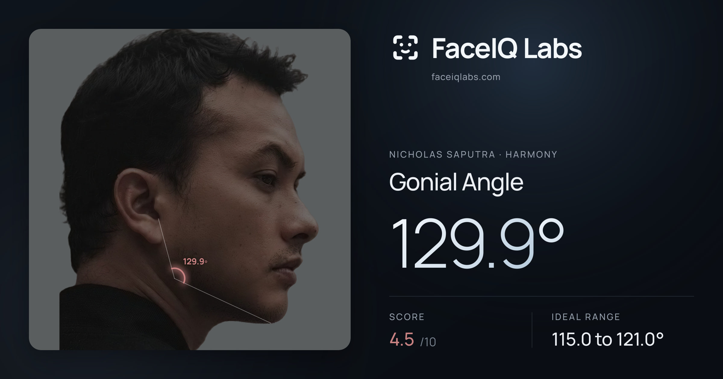 Nicholas Saputra Gonial Angle: 129.9°, drawn on the photo
