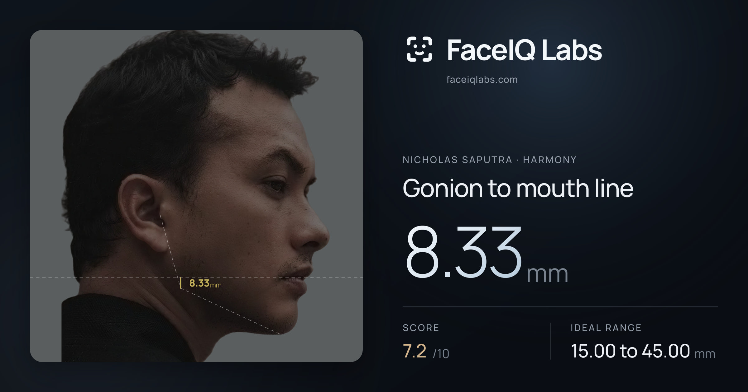 Nicholas Saputra Gonion to mouth line: 8.33mm, drawn on the photo