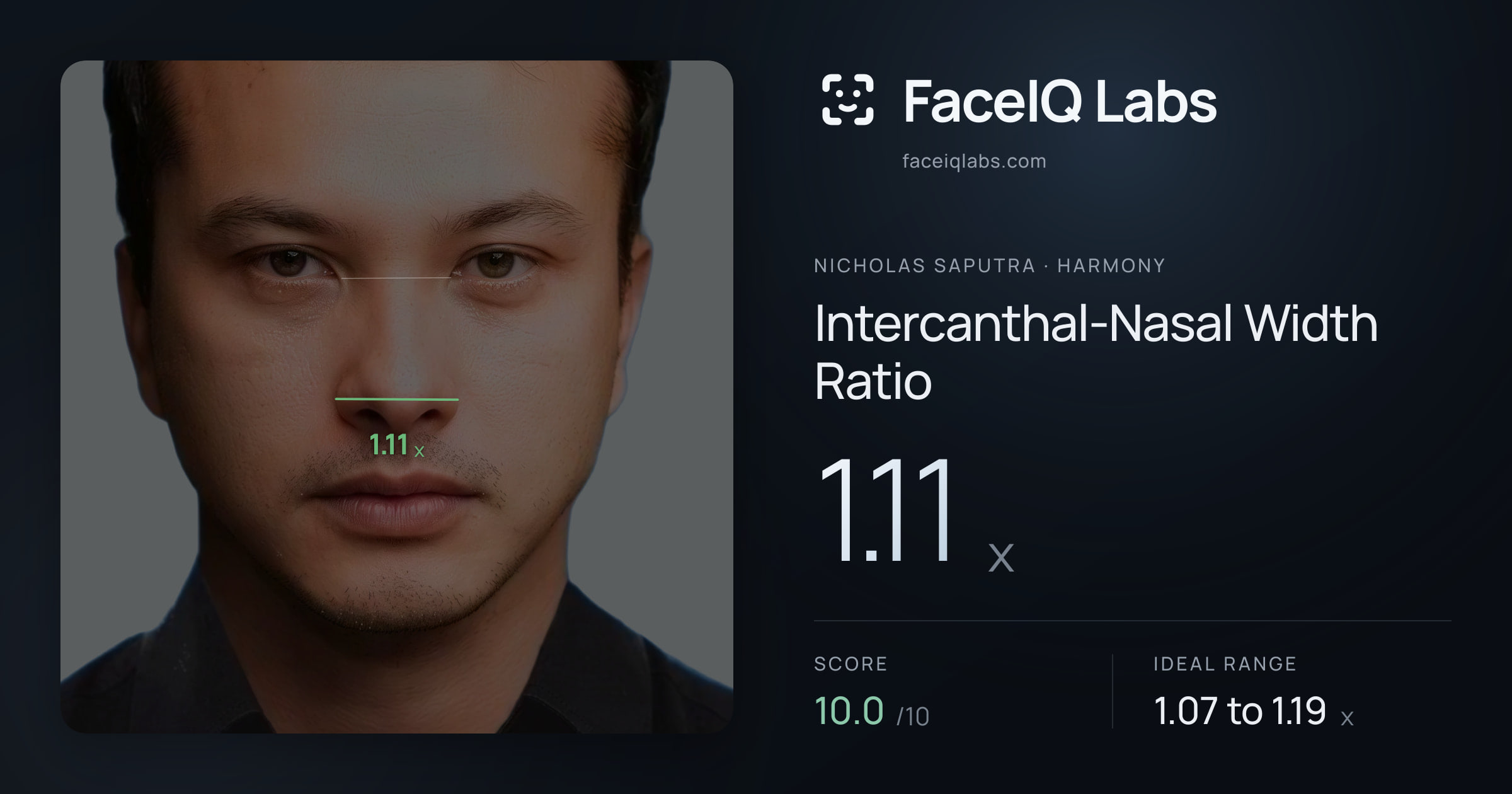 Nicholas Saputra Intercanthal-Nasal Width Ratio: 1.11x, drawn on the photo