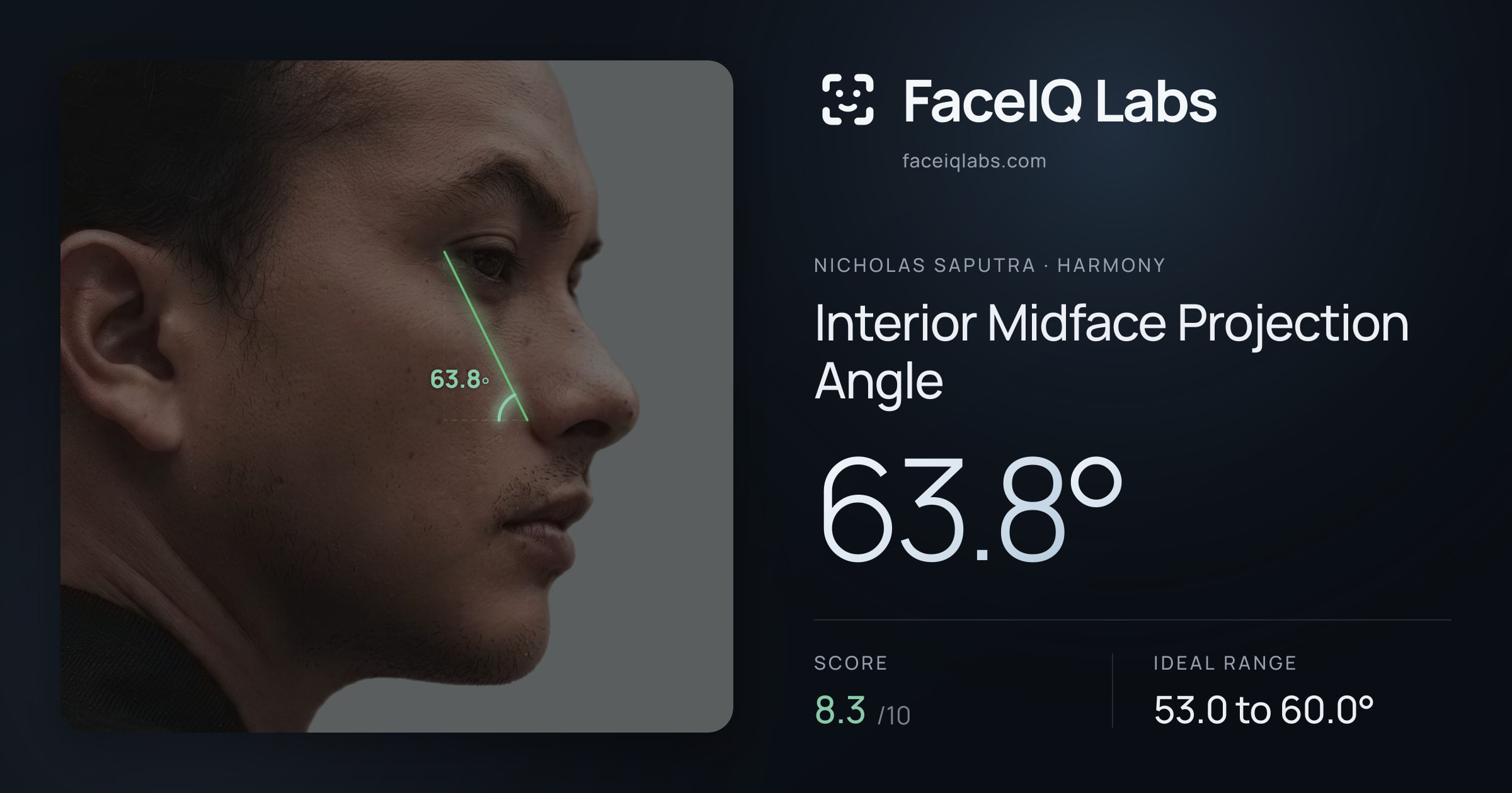 Nicholas Saputra Interior Midface Projection Angle: 63.8°, drawn on the photo
