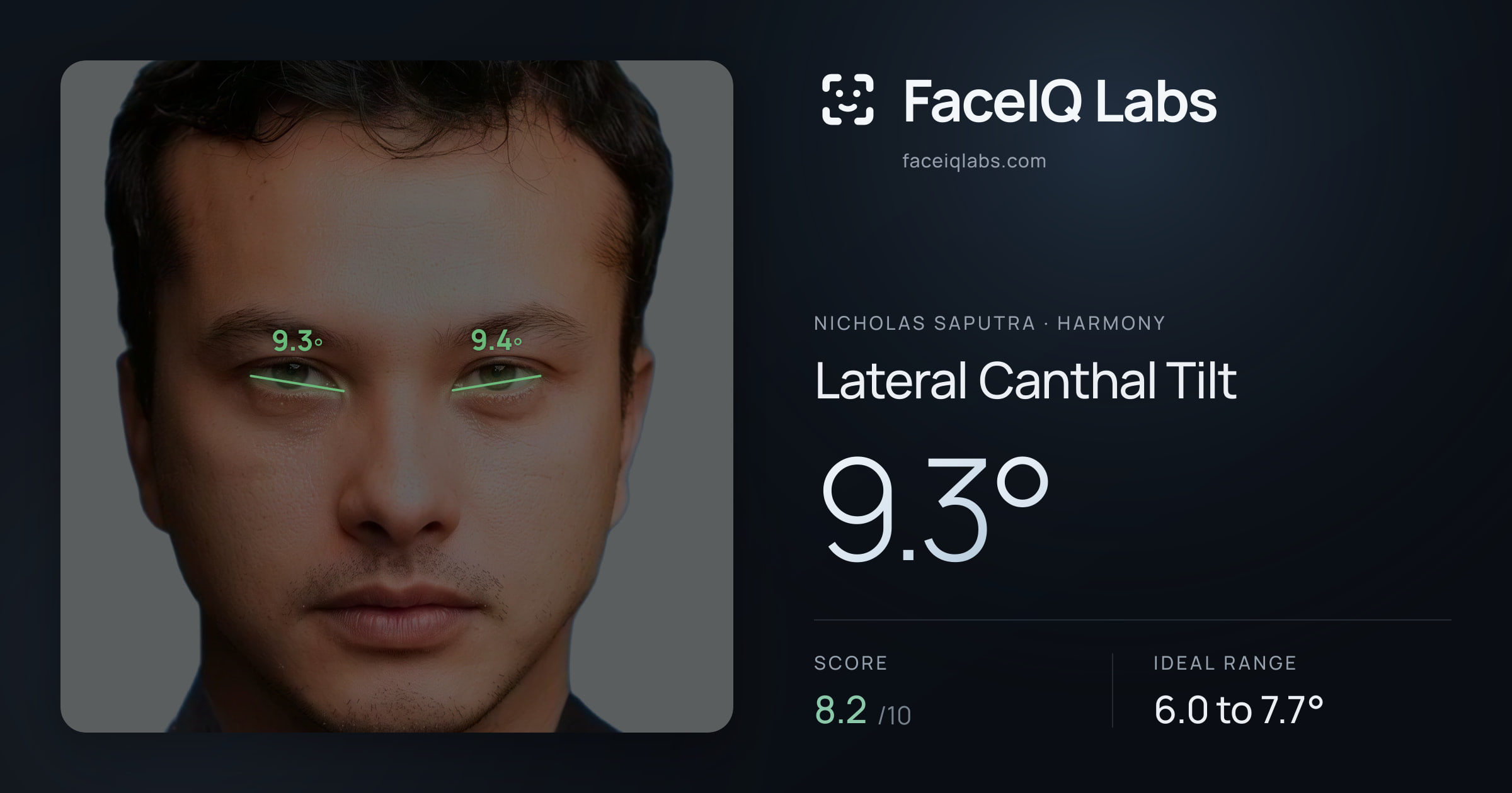Nicholas Saputra Lateral Canthal Tilt: 9.3°, drawn on the photo