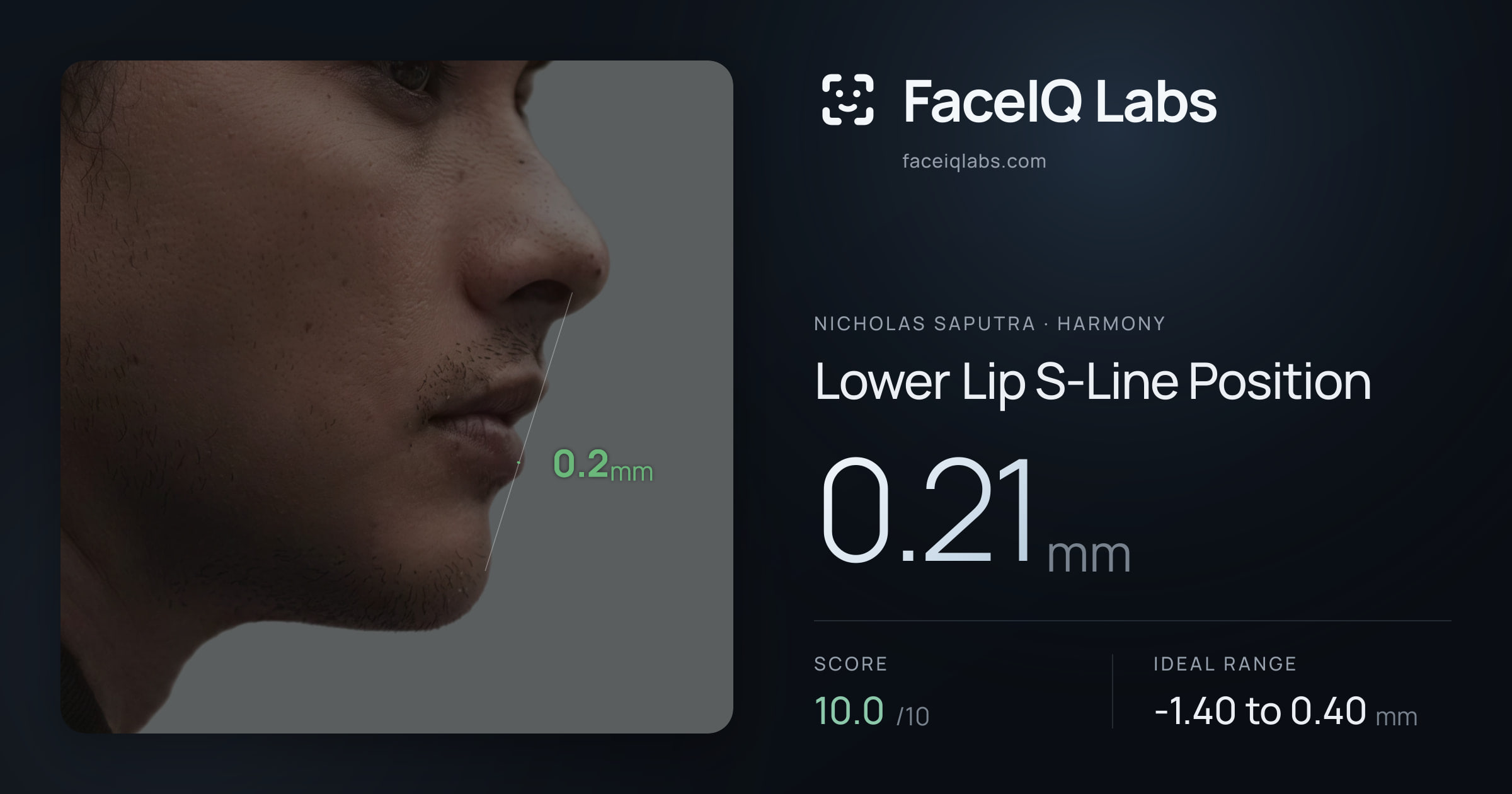 Nicholas Saputra Lower Lip S-Line Position: 0.21mm, drawn on the photo