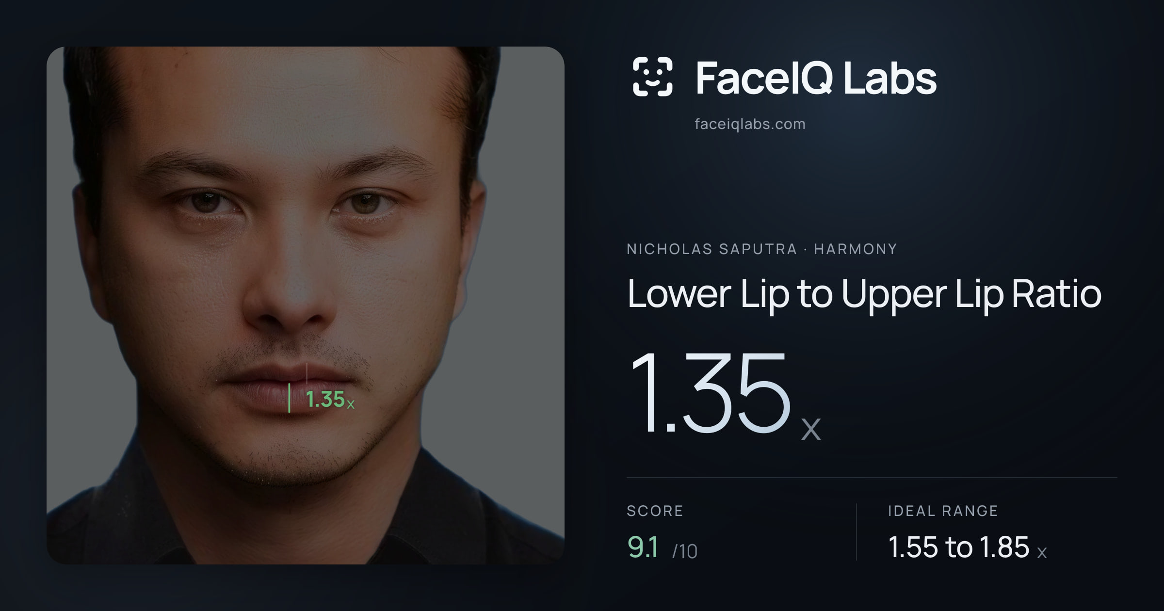 Nicholas Saputra Lower Lip to Upper Lip Ratio: 1.35x, drawn on the photo