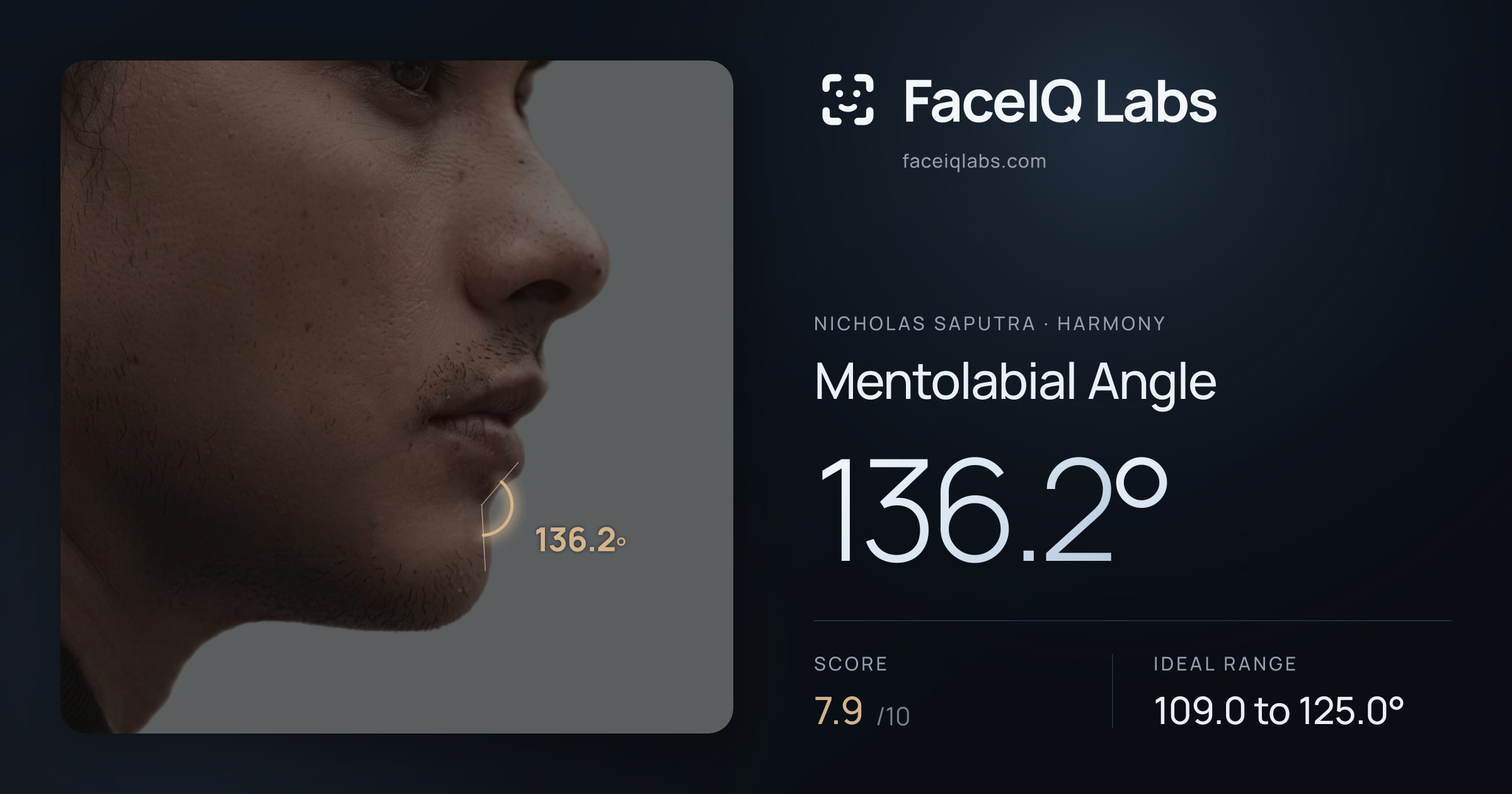 Nicholas Saputra Mentolabial Angle: 136.2°, drawn on the photo