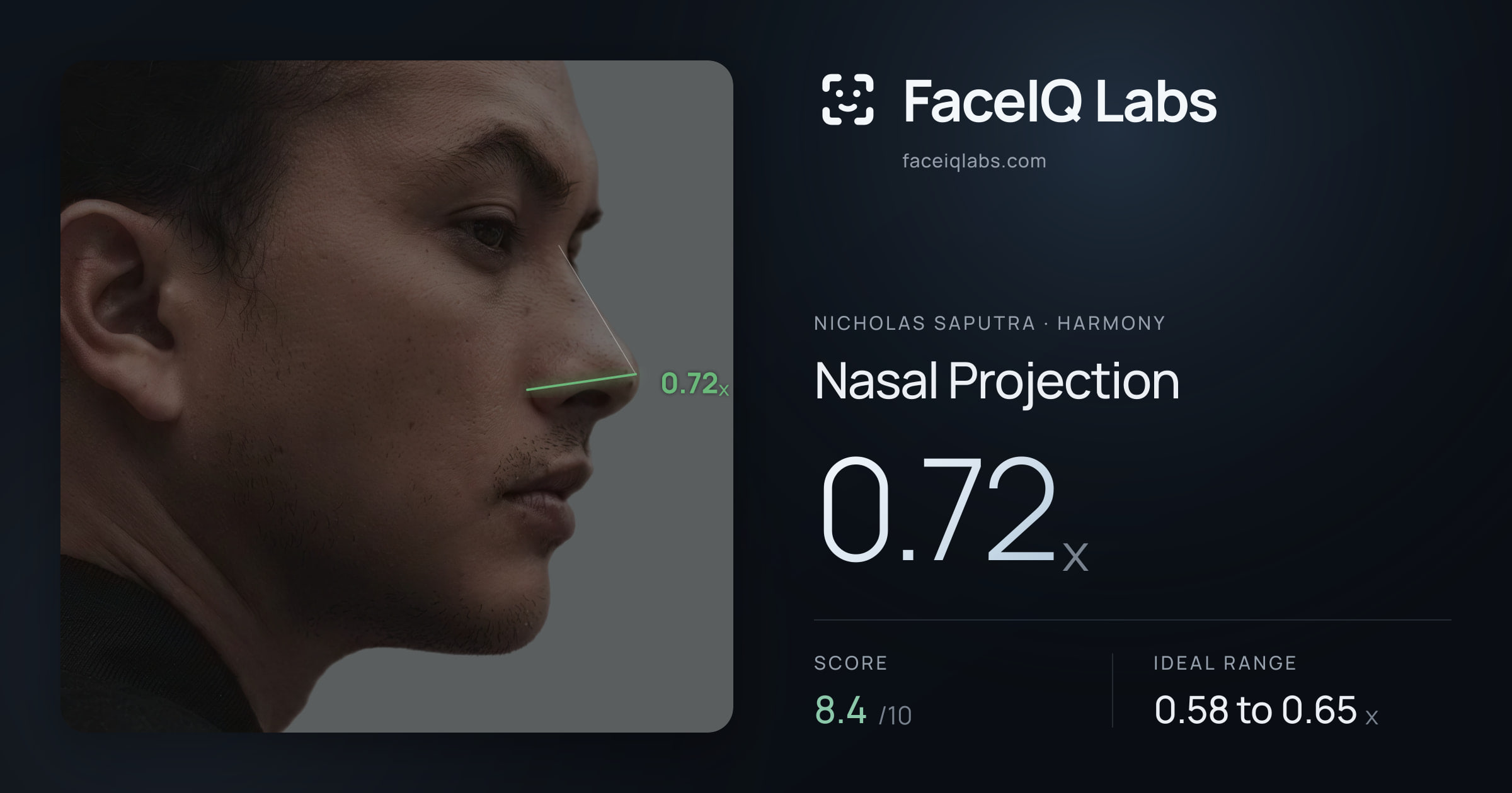 Nicholas Saputra Nasal Projection: 0.72x, drawn on the photo