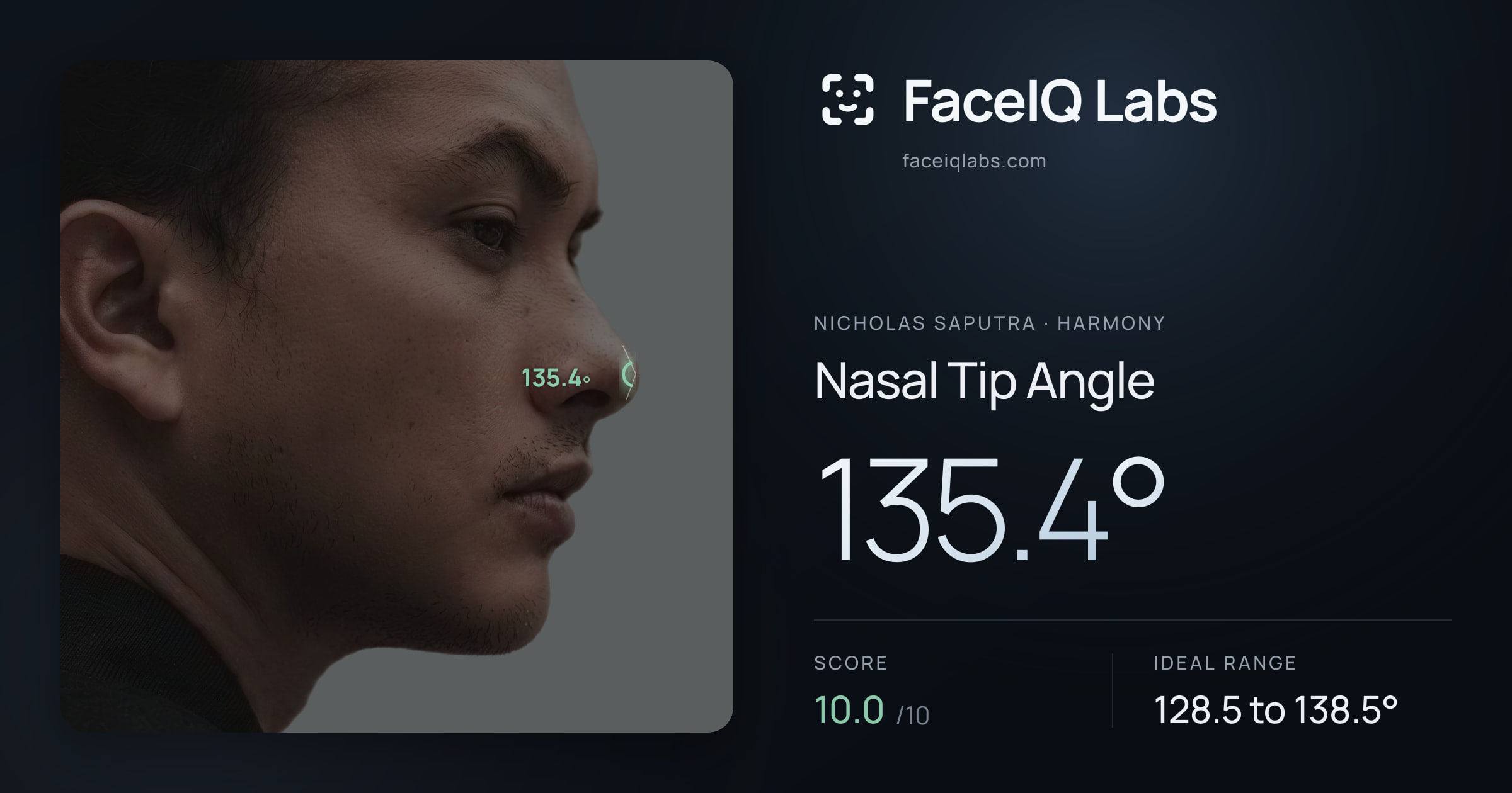 Nicholas Saputra Nasal Tip Angle: 135.4°, drawn on the photo