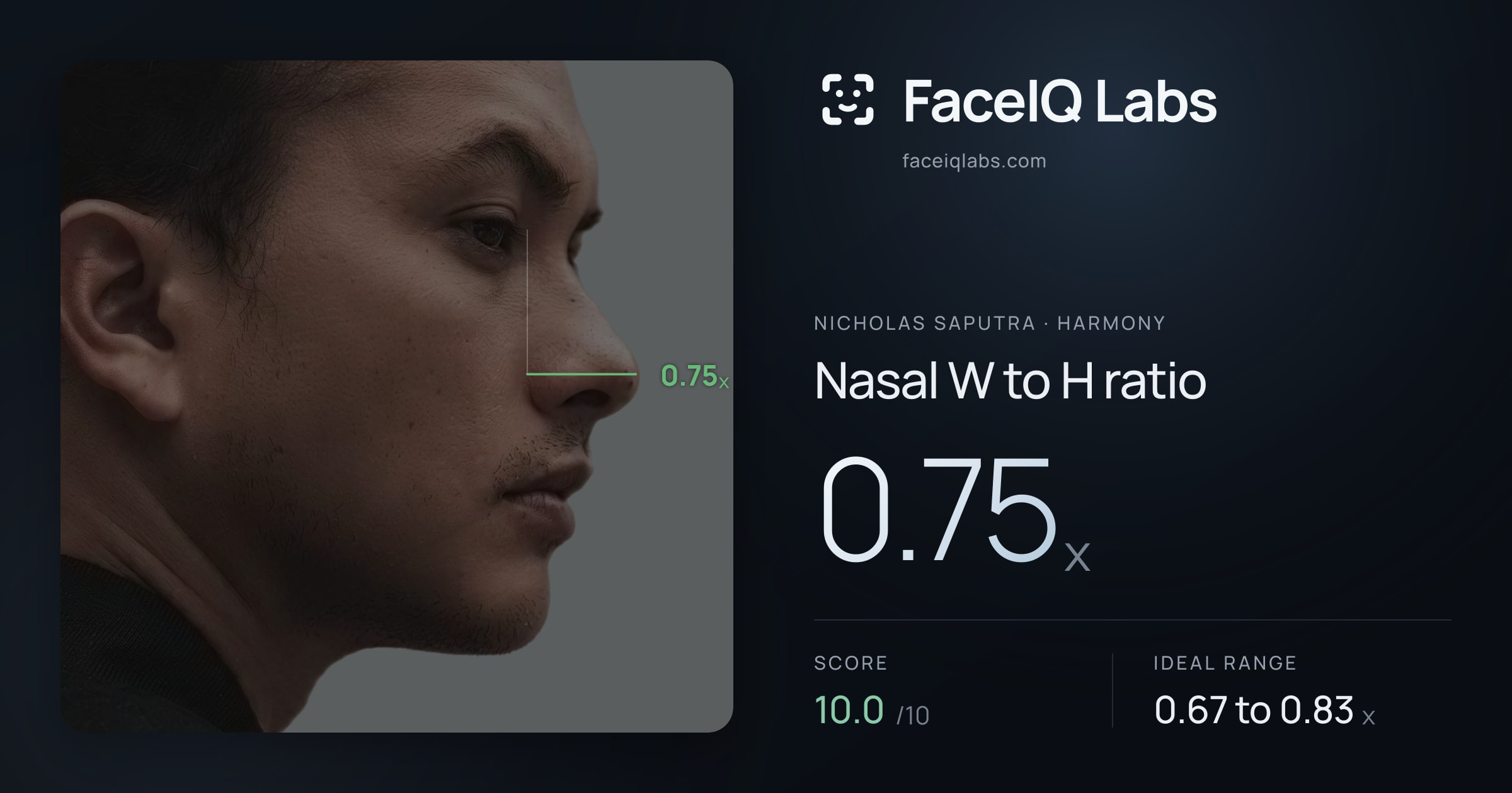 Nicholas Saputra Nasal W to H ratio: 0.75x, drawn on the photo