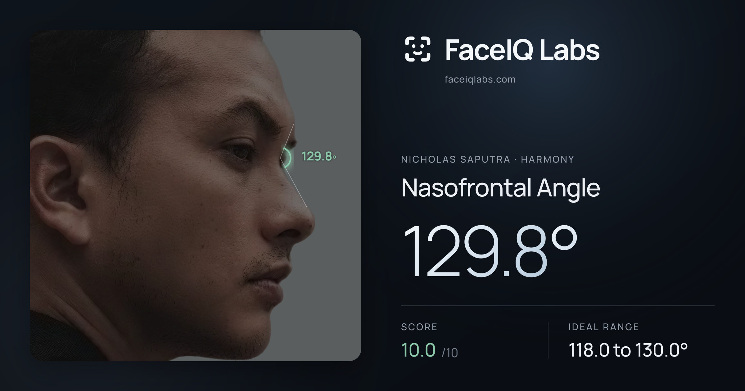 Nicholas Saputra Nasofrontal Angle: 129.8°, drawn on the photo