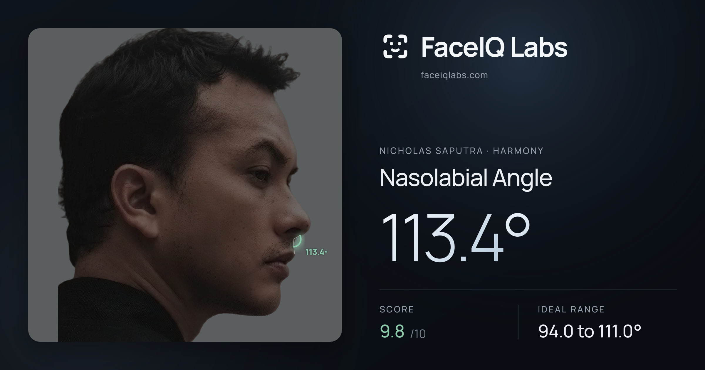 Nicholas Saputra Nasolabial Angle: 113.4°, drawn on the photo