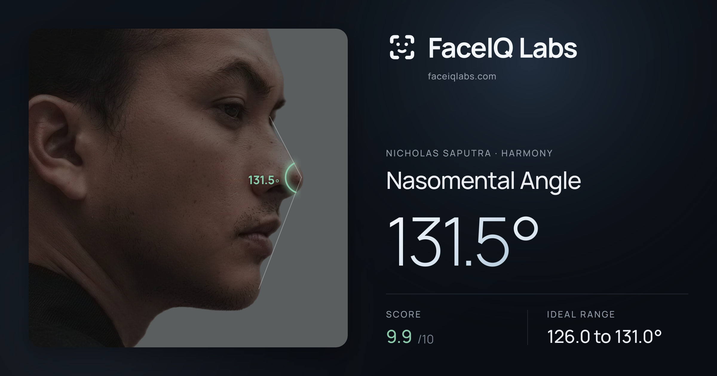 Nicholas Saputra Nasomental Angle: 131.5°, drawn on the photo