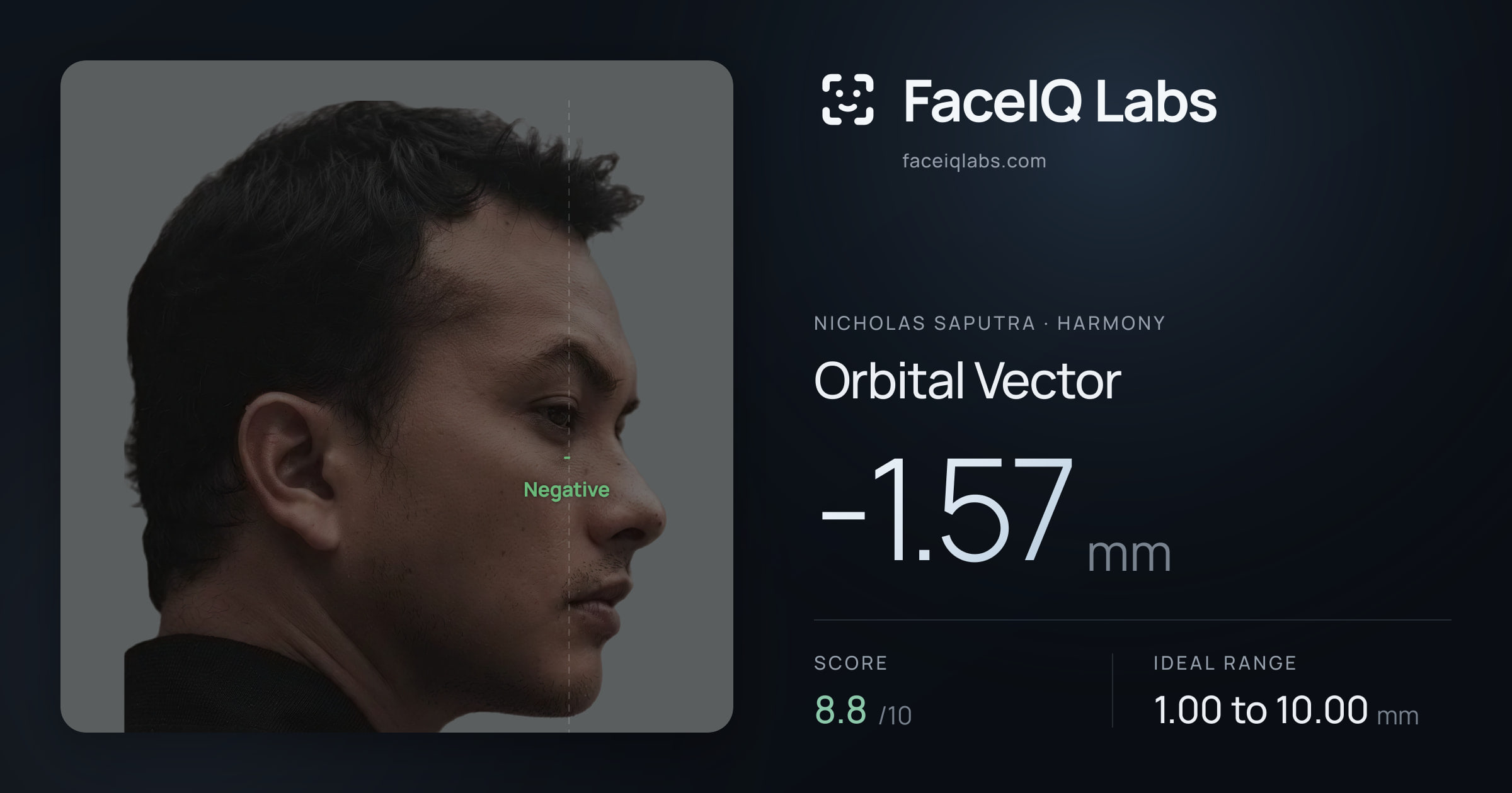 Nicholas Saputra Orbital Vector: -1.57mm, drawn on the photo