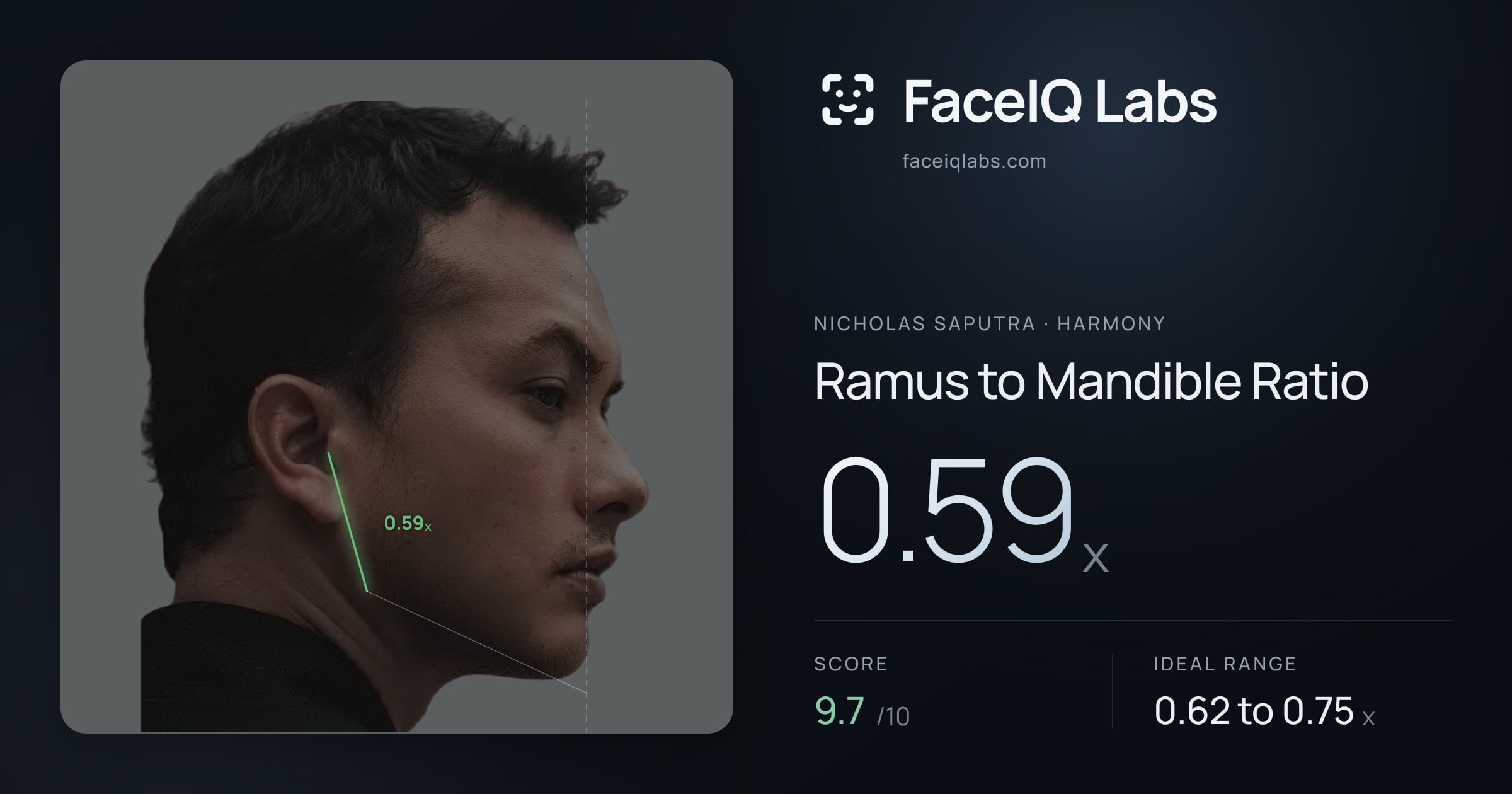 Nicholas Saputra Ramus to Mandible Ratio: 0.59x, drawn on the photo