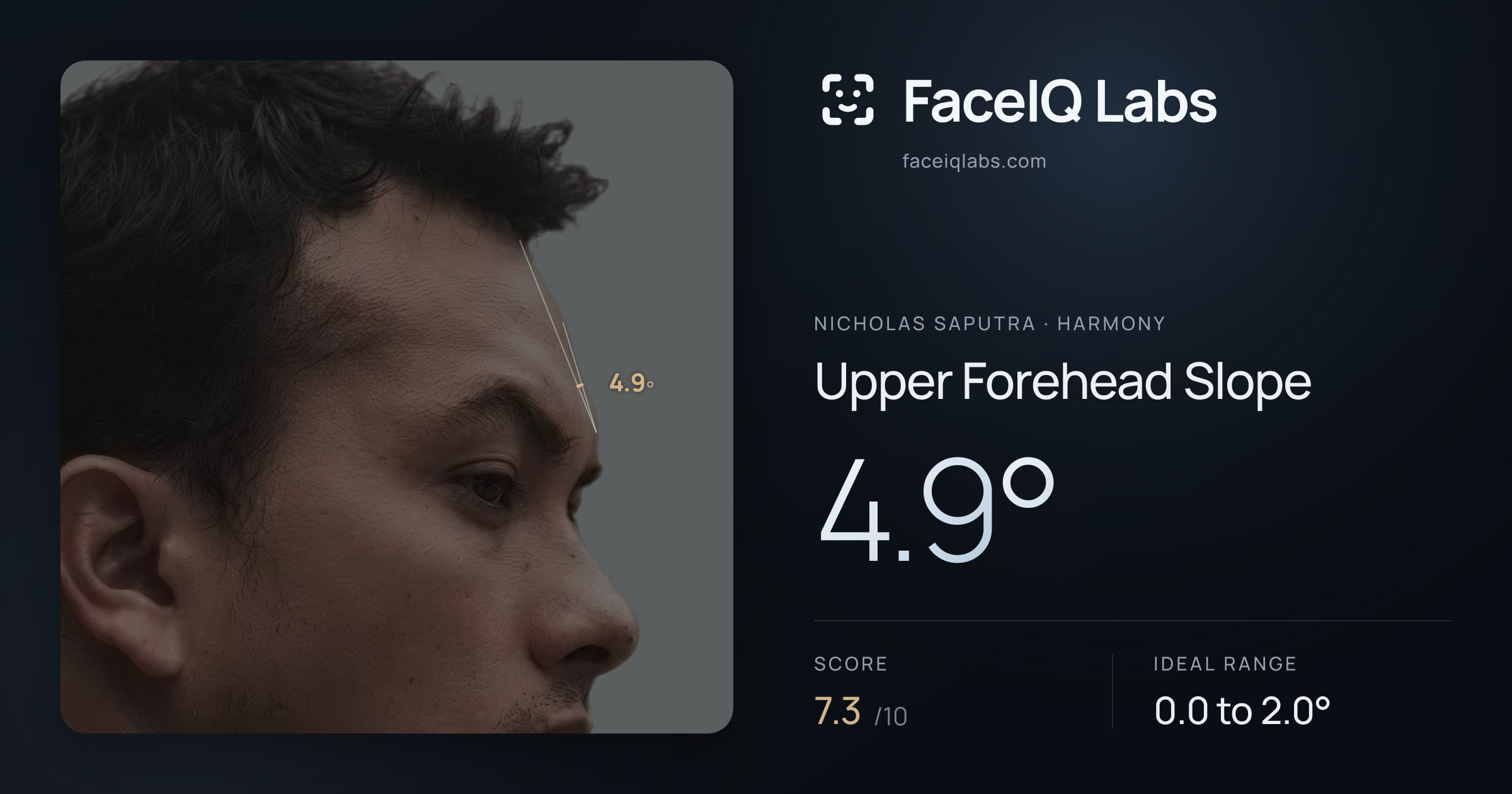 Nicholas Saputra Upper Forehead Slope: 4.9°, drawn on the photo