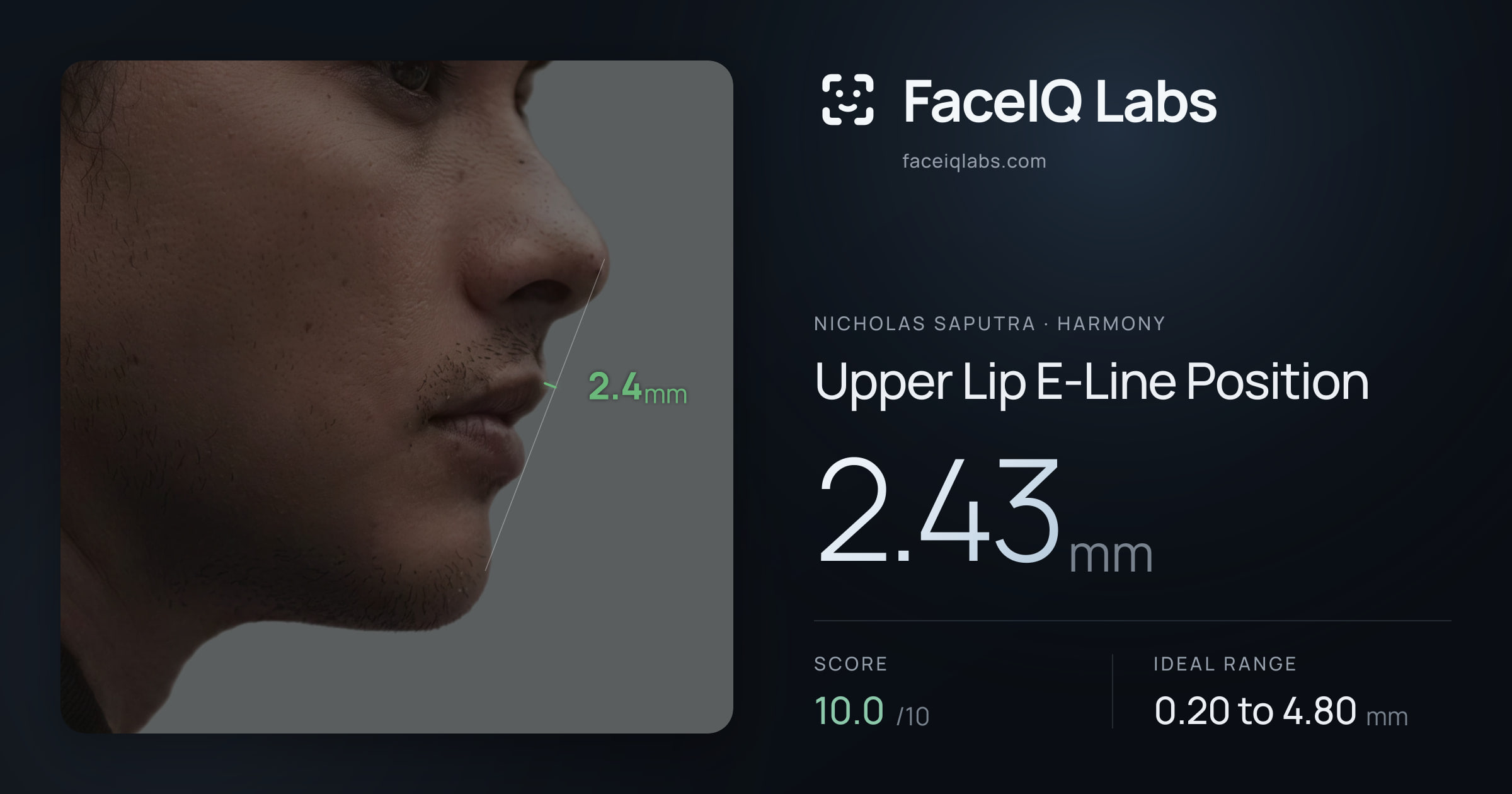 Nicholas Saputra Upper Lip E-Line Position: 2.43mm, drawn on the photo