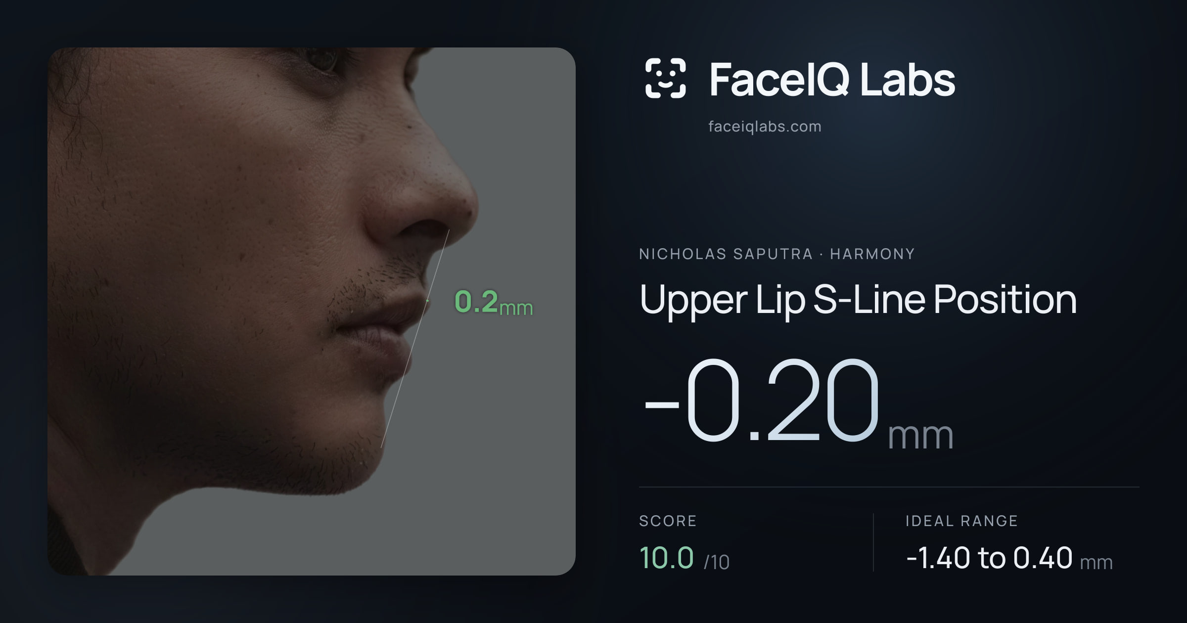 Nicholas Saputra Upper Lip S-Line Position: -0.20mm, drawn on the photo