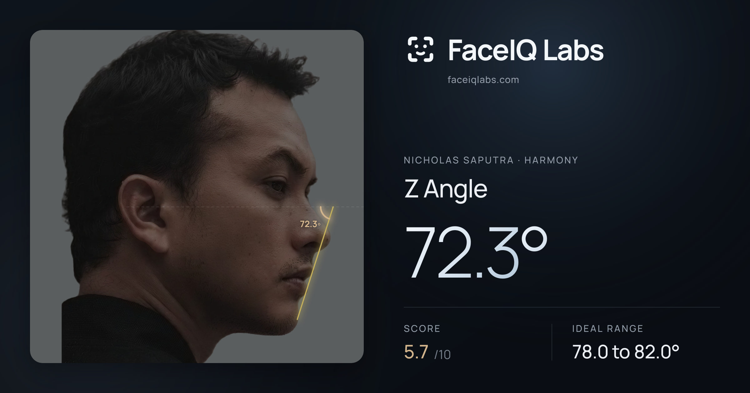 Nicholas Saputra Z Angle: 72.3°, drawn on the photo